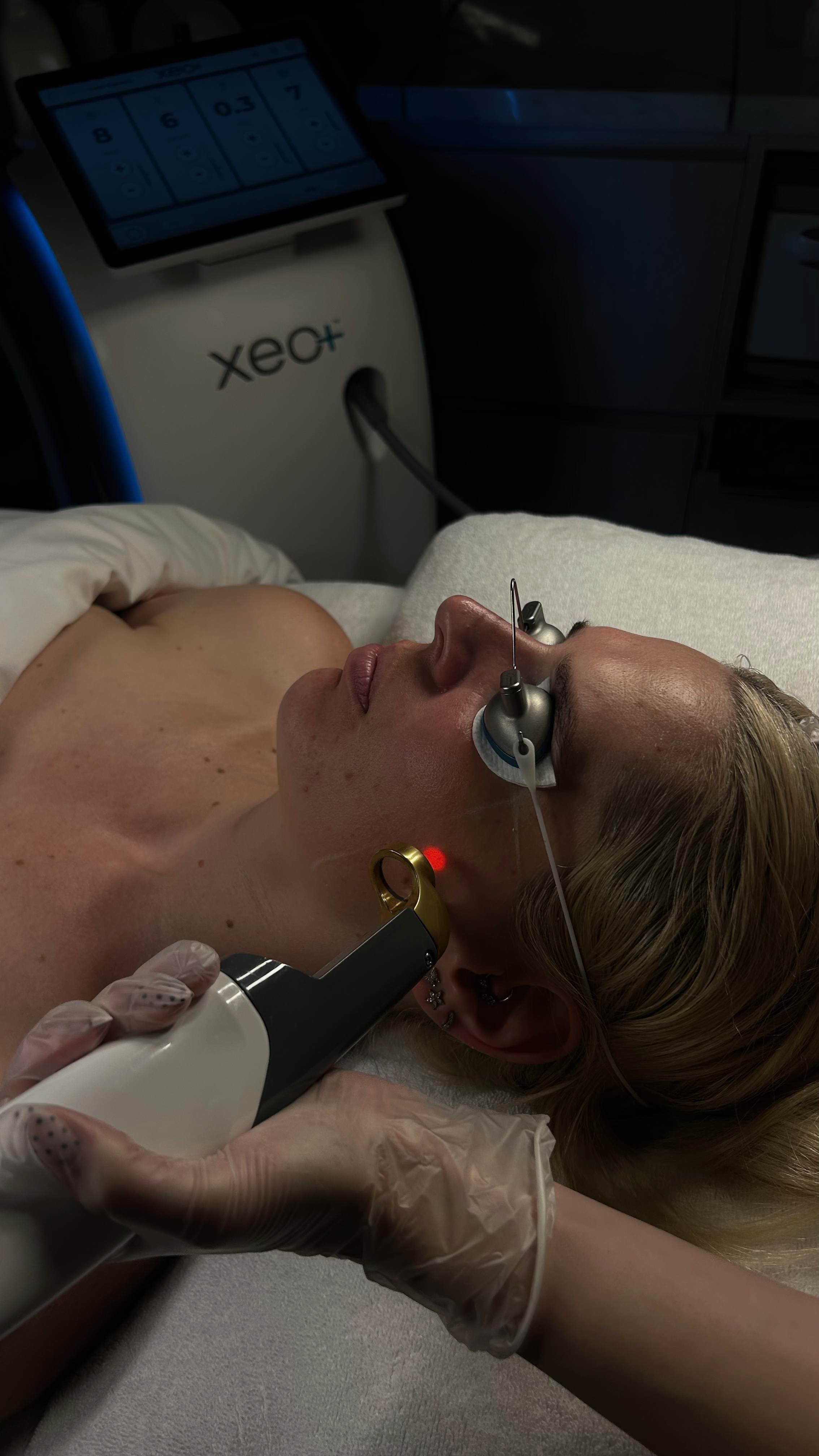 Skin Synergy Treatments - Buy 3 Get One FREE