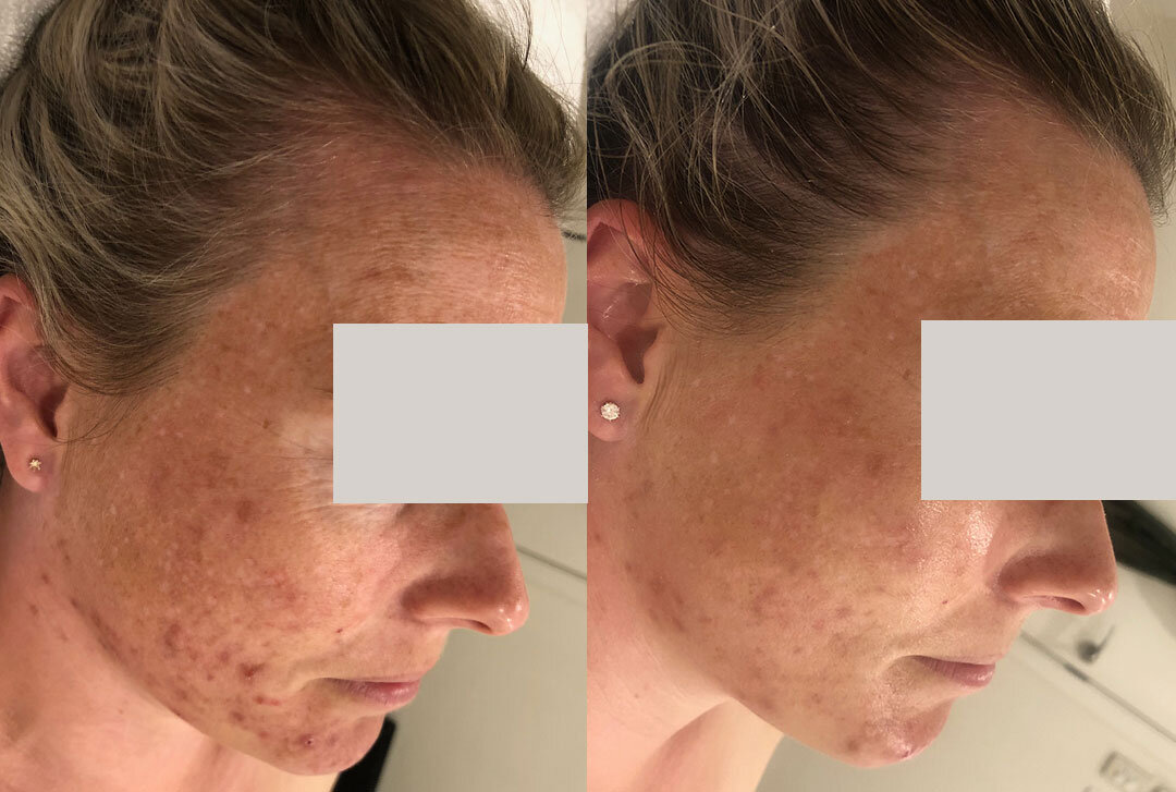 Award-Winning Skin Results