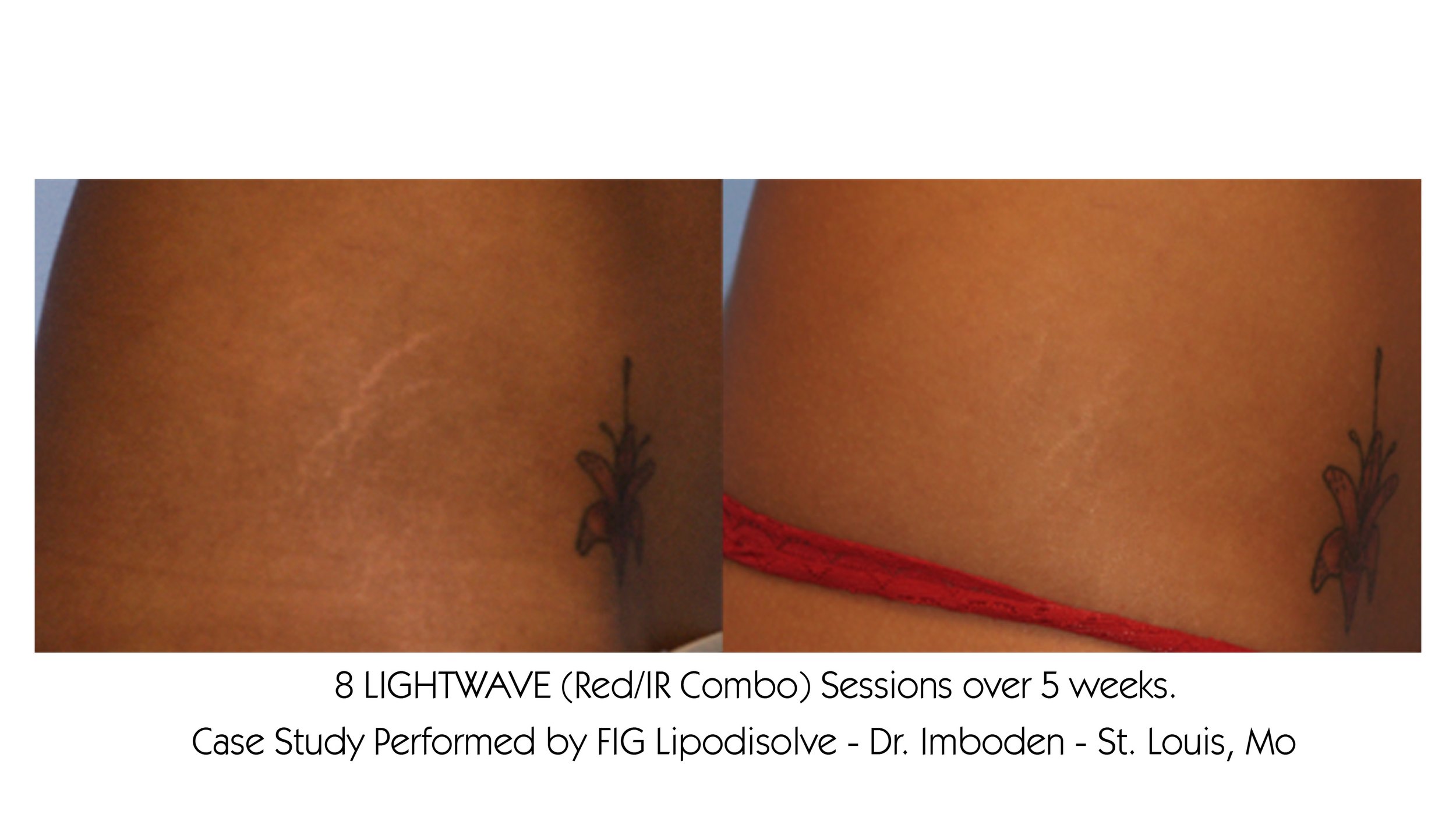 PRINT_StretchMarks_03.jpg
