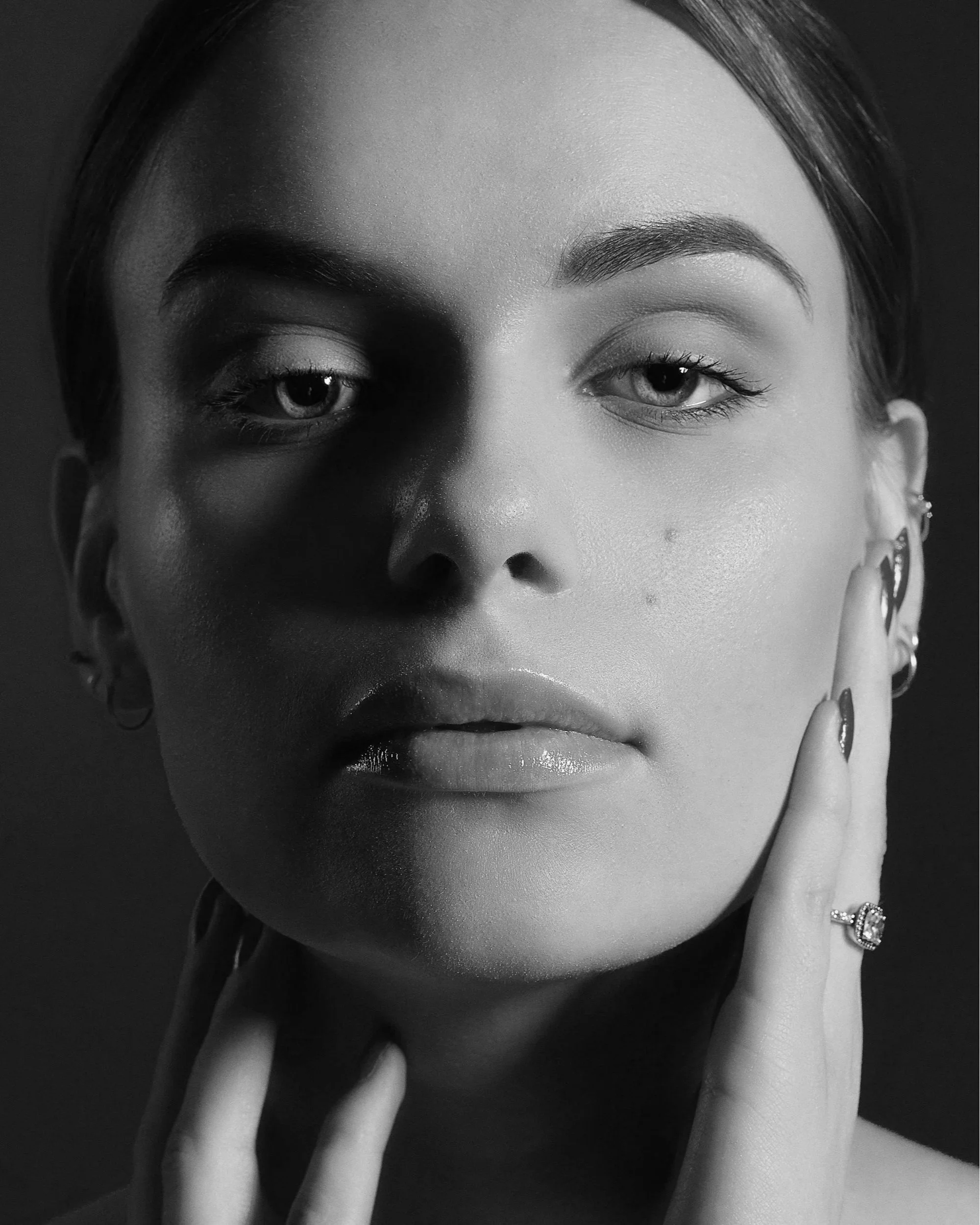 What Is The Root Cause of Acne According To GNM?