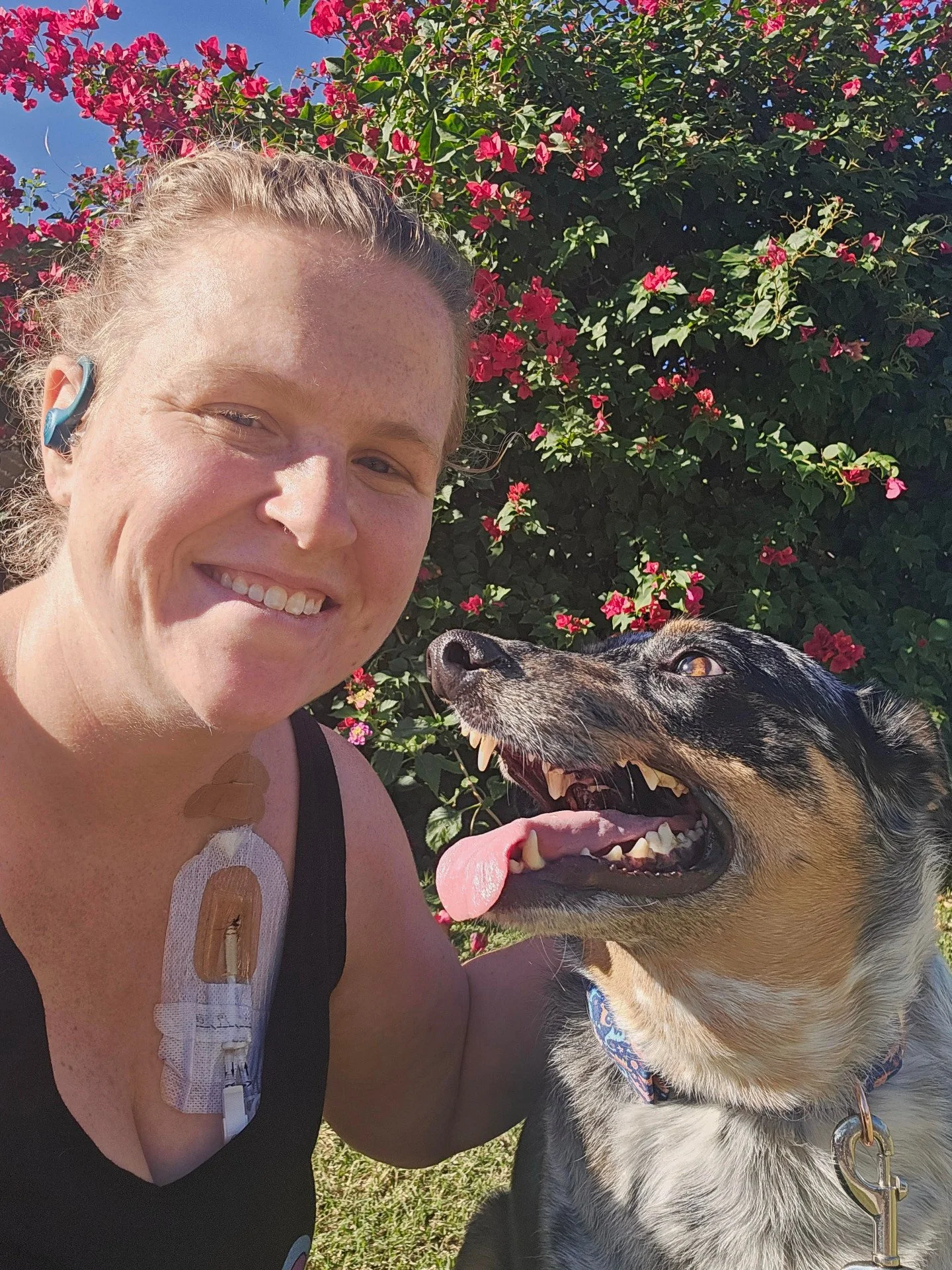 &ldquo;Hi, I&rsquo;m Mary El. I&rsquo;ve been living with chronic Lyme disease for over eight years &mdash; though for most of that time, I had no idea what was actually causing my pain. My symptoms began after a surgical complication at 21 that trig