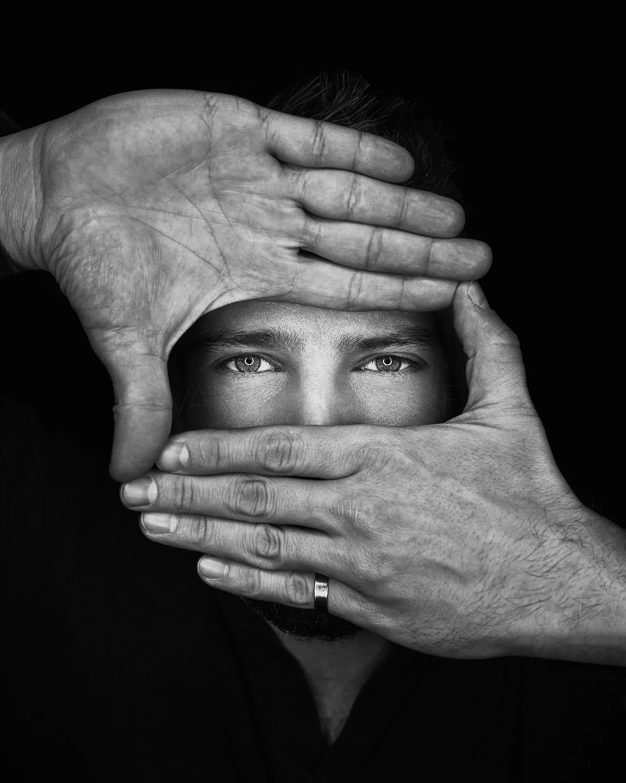Black and white photo of a man with light eyes, holding his face with both hands, one covering his forehead and the other covering his mouth.