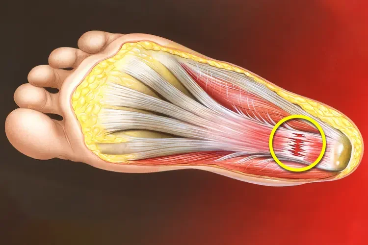 Heel Pain That Will Not Go Away? Here Is When to Get Help