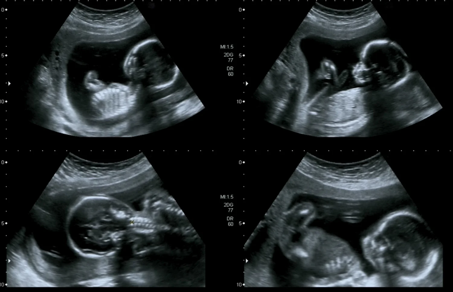 General Ultrasound — Bolton Medical Imaging