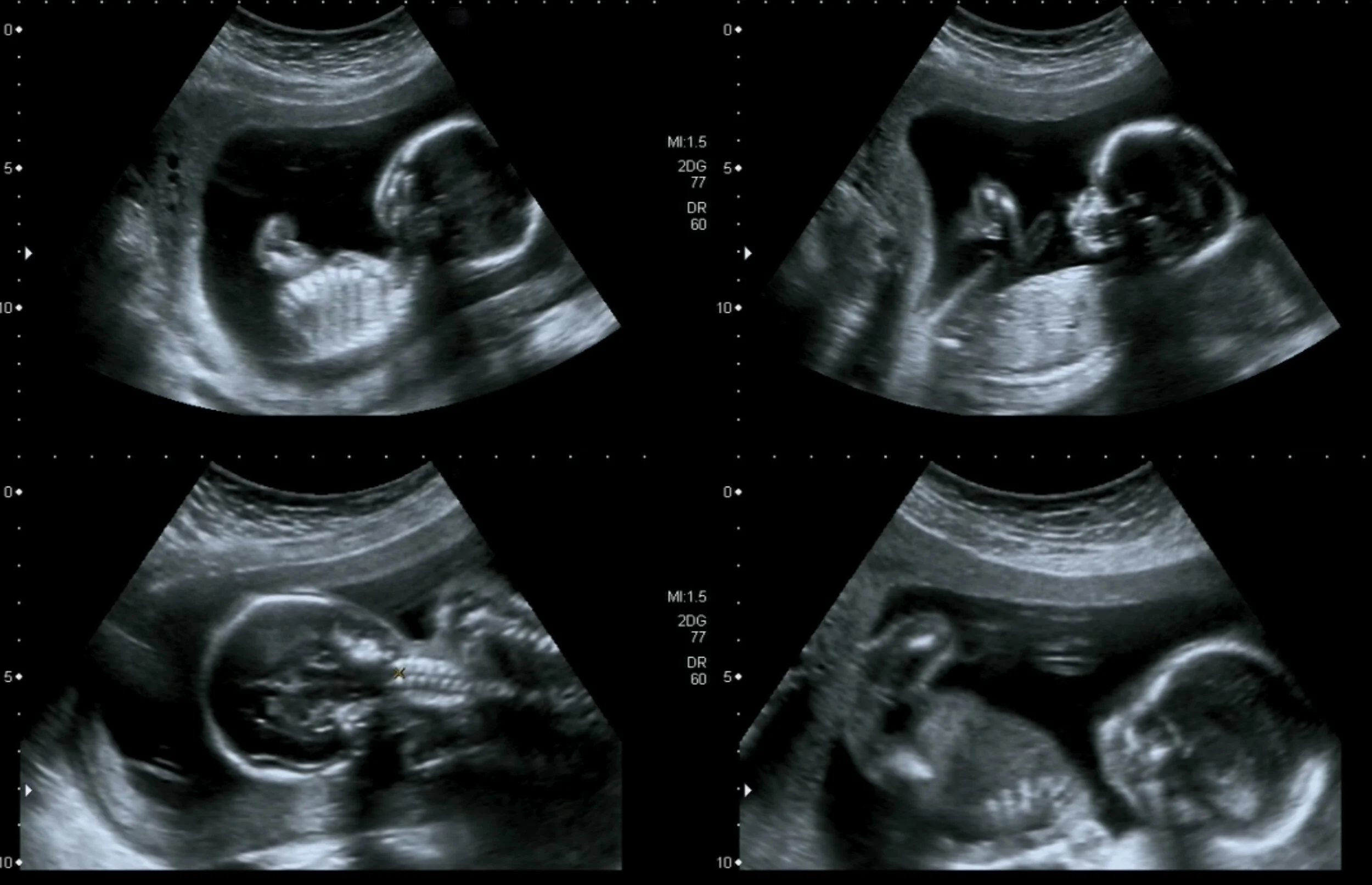 General Ultrasound — Bolton Medical Imaging