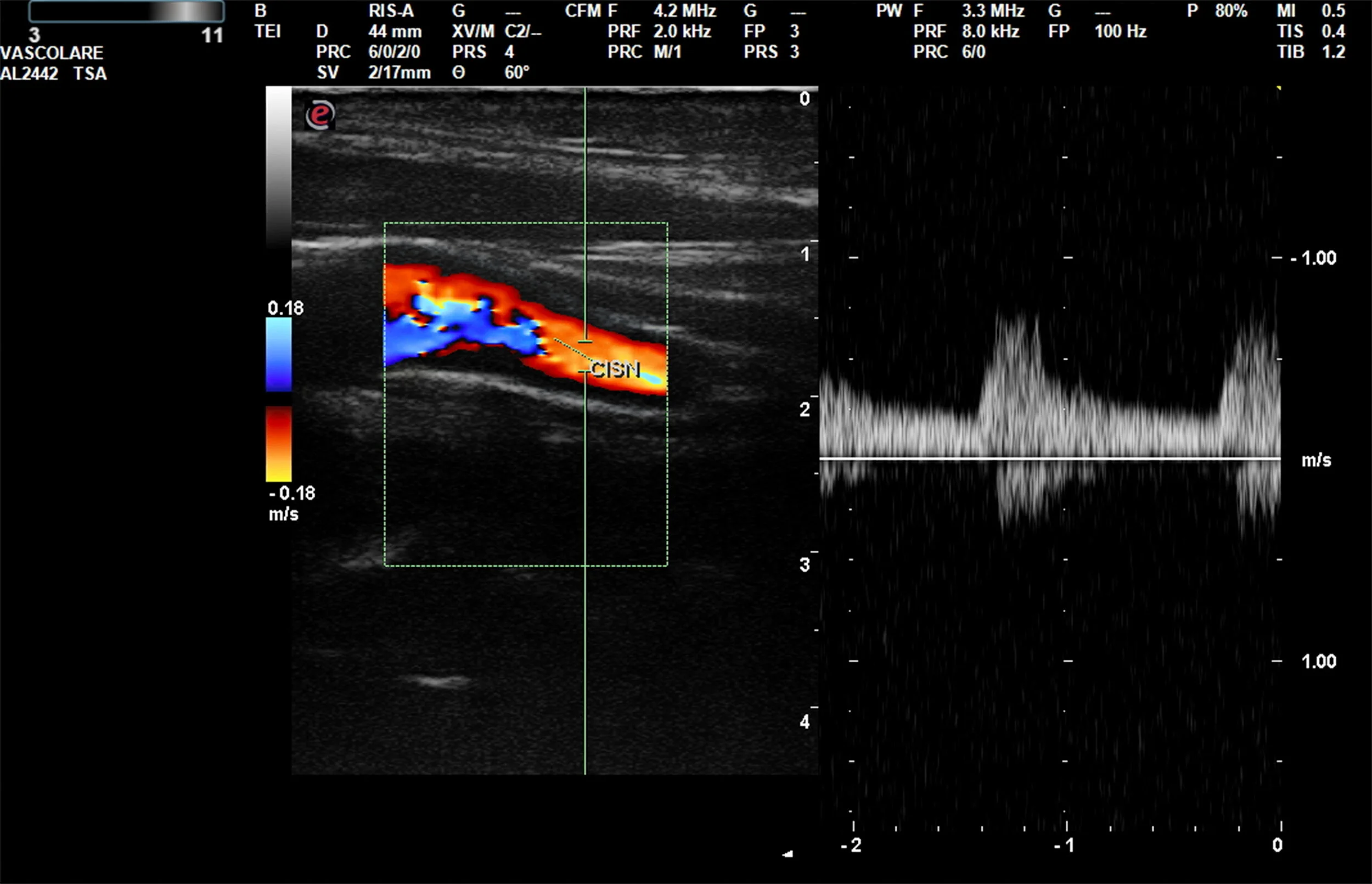 Vascular Ultrasound — Bolton Medical Imaging