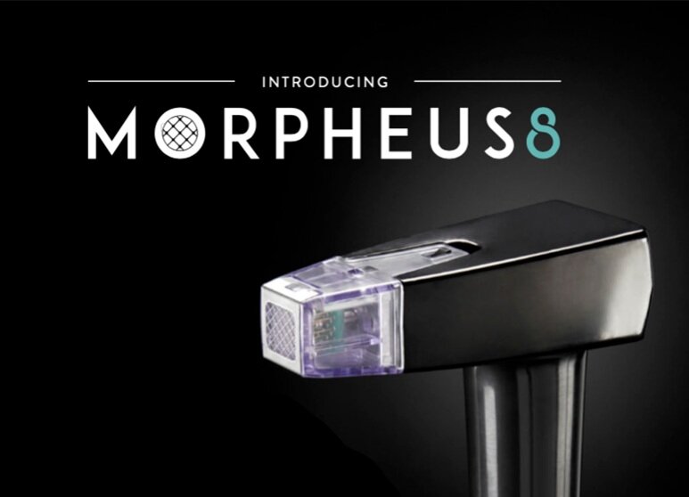 morpheus82.jpg