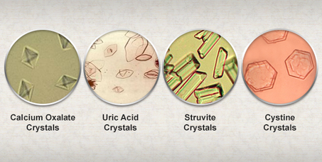 Bladder Stones in Dogs and Cats