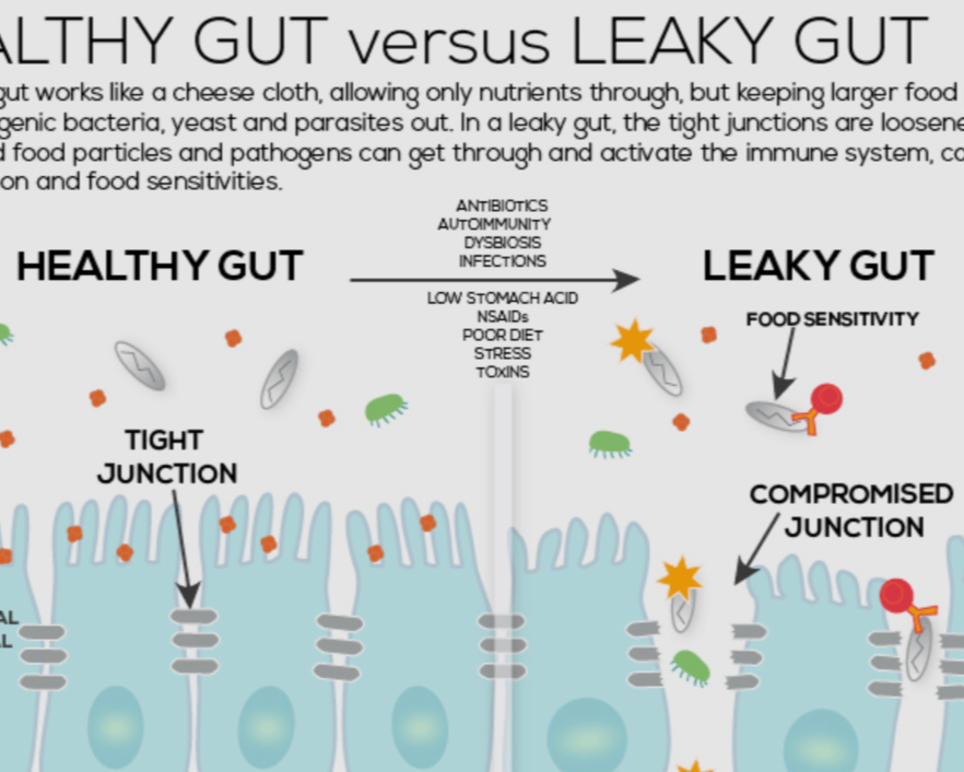What if your bloat, mood and skin issues come from the same root?&nbsp;