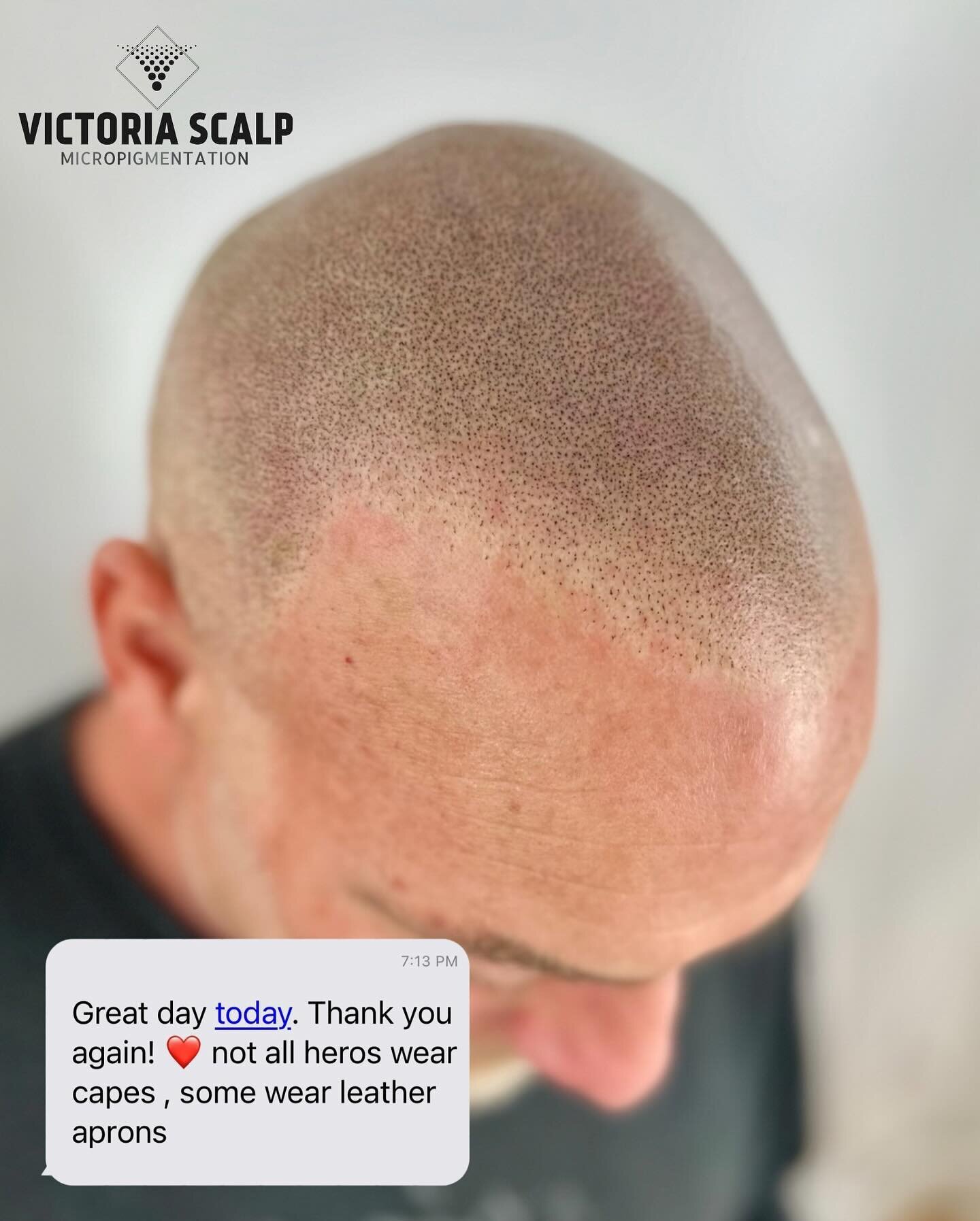 CROWN TO HAIRLINE SMP
Client feedback - Session 3 🥰
&gt;&gt;&gt;Swipe for BEFORE photo

Big thanks to Will for my favourite text of 2024 so far! My clients are the best, and I&rsquo;m so fortunate to have a career I love. Six days a week, nothing bu