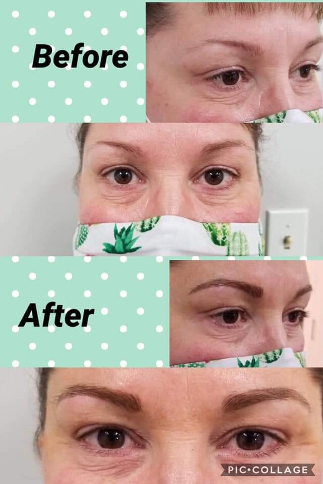 Microblading