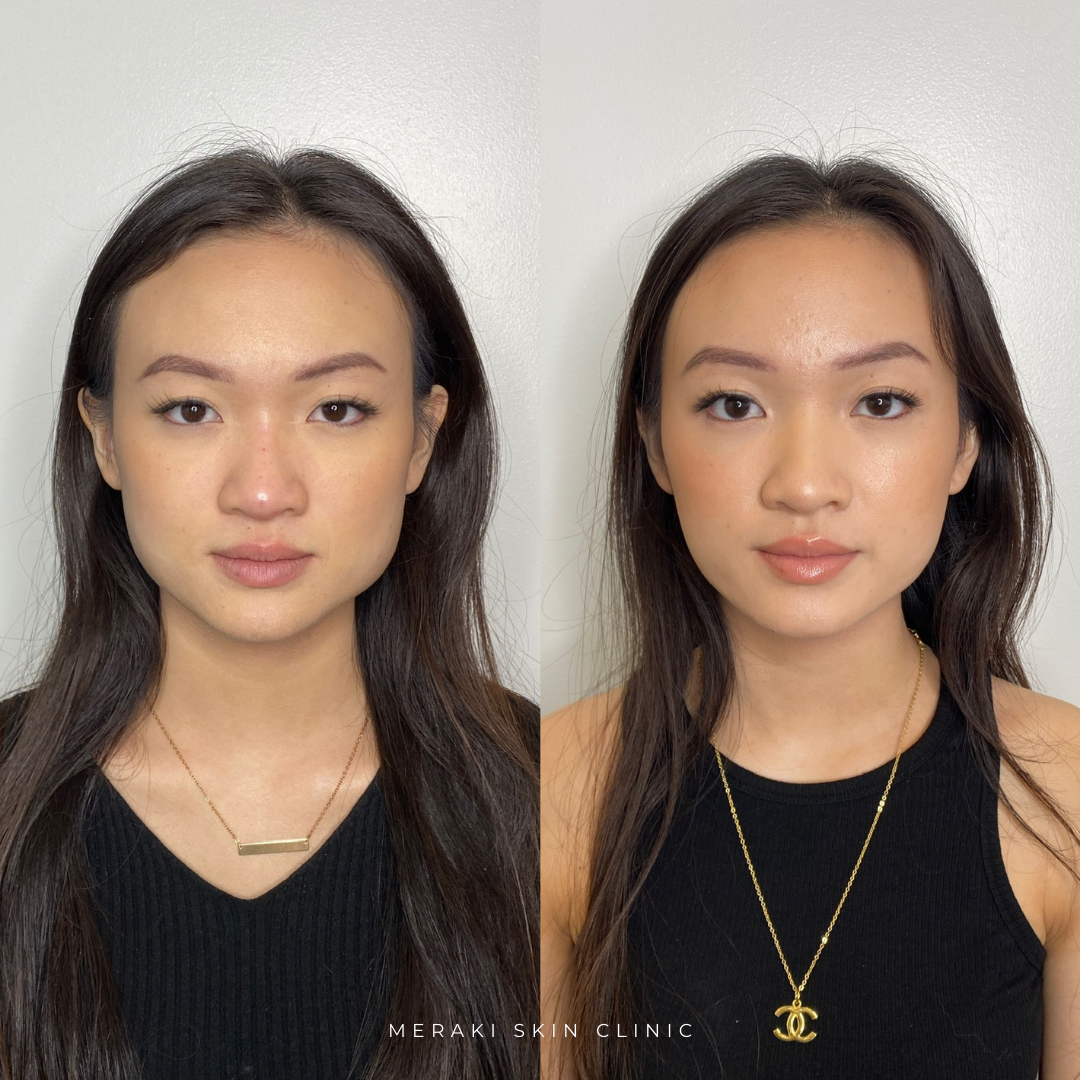 Meraki Skin Clinic