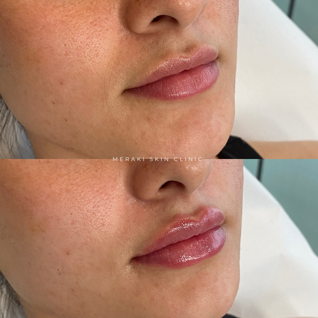 Meraki's Mini Lip