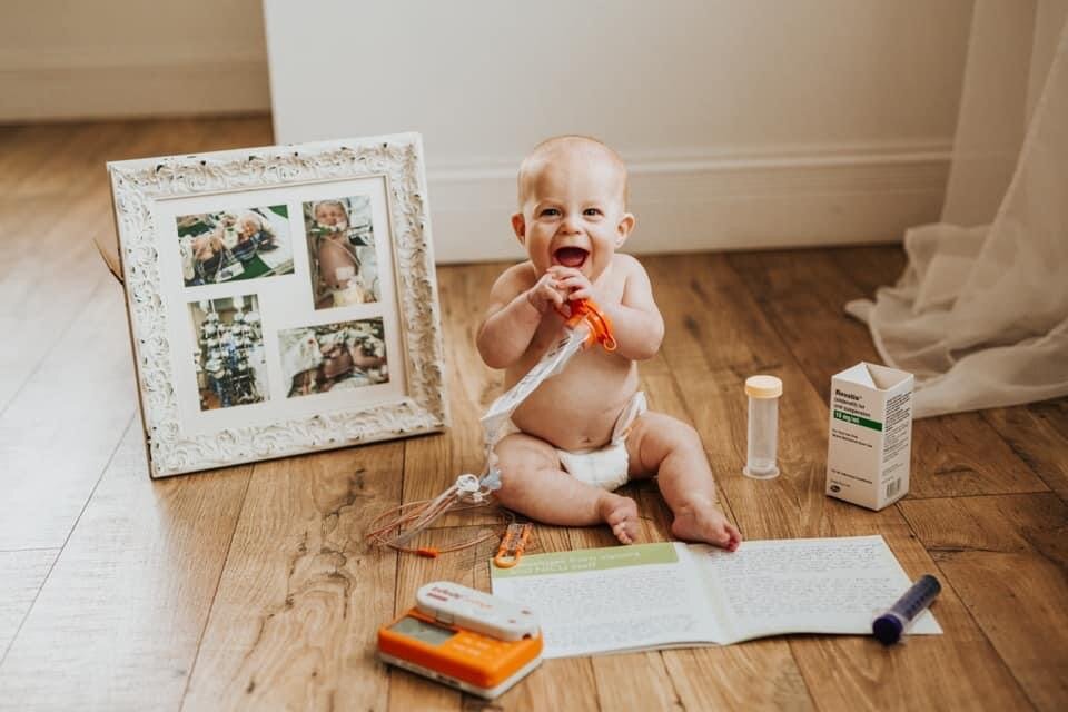 Baby with G-tube