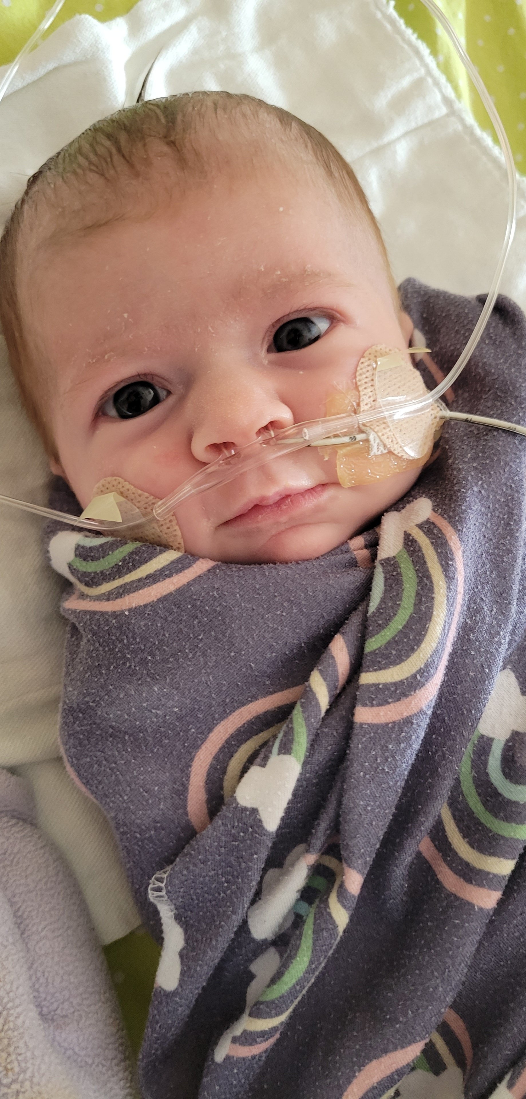 Avery - Casey Patterson - LCDH ECMO 3.jpg