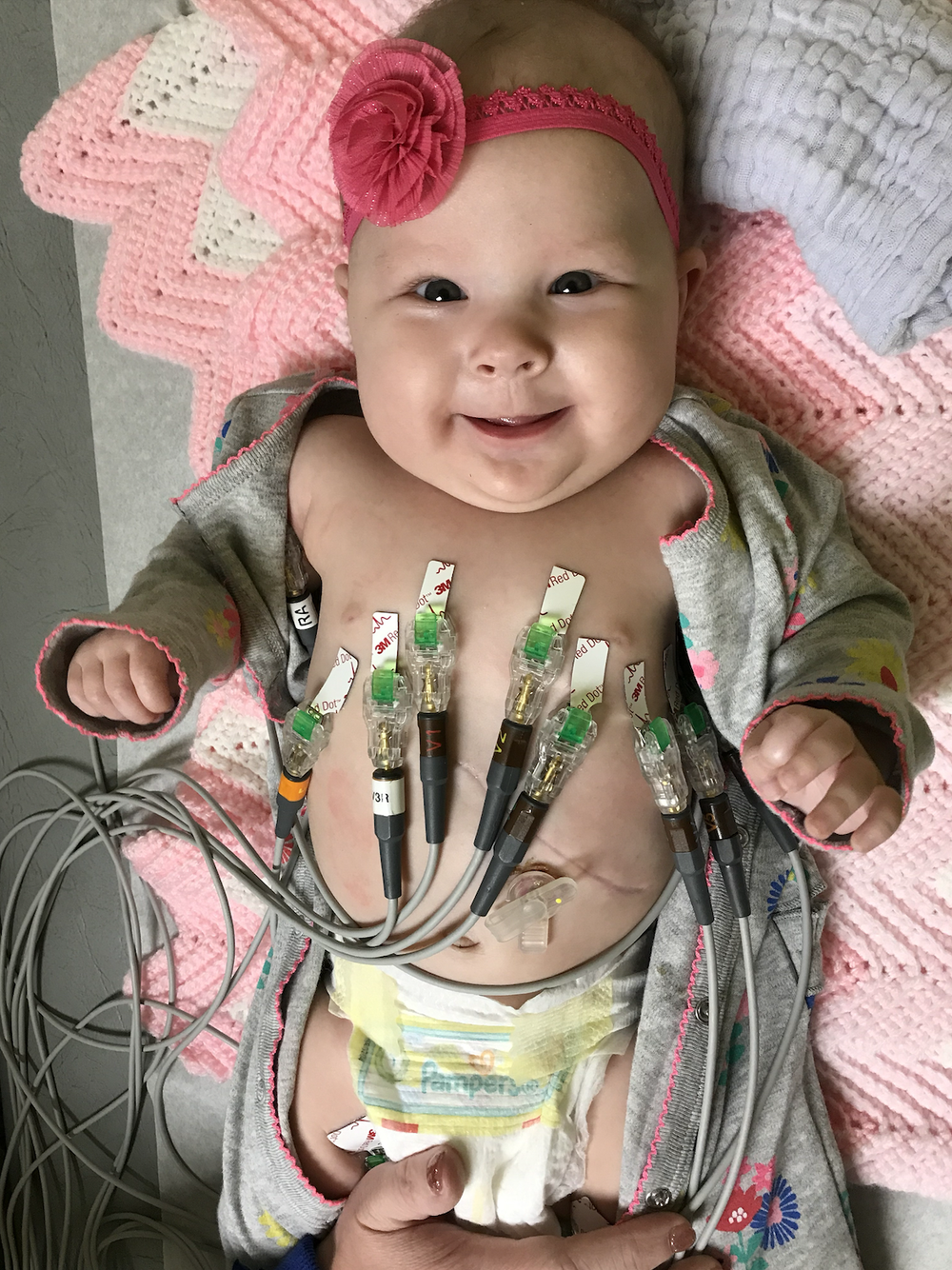 Tiny Hero Scarlett EKG