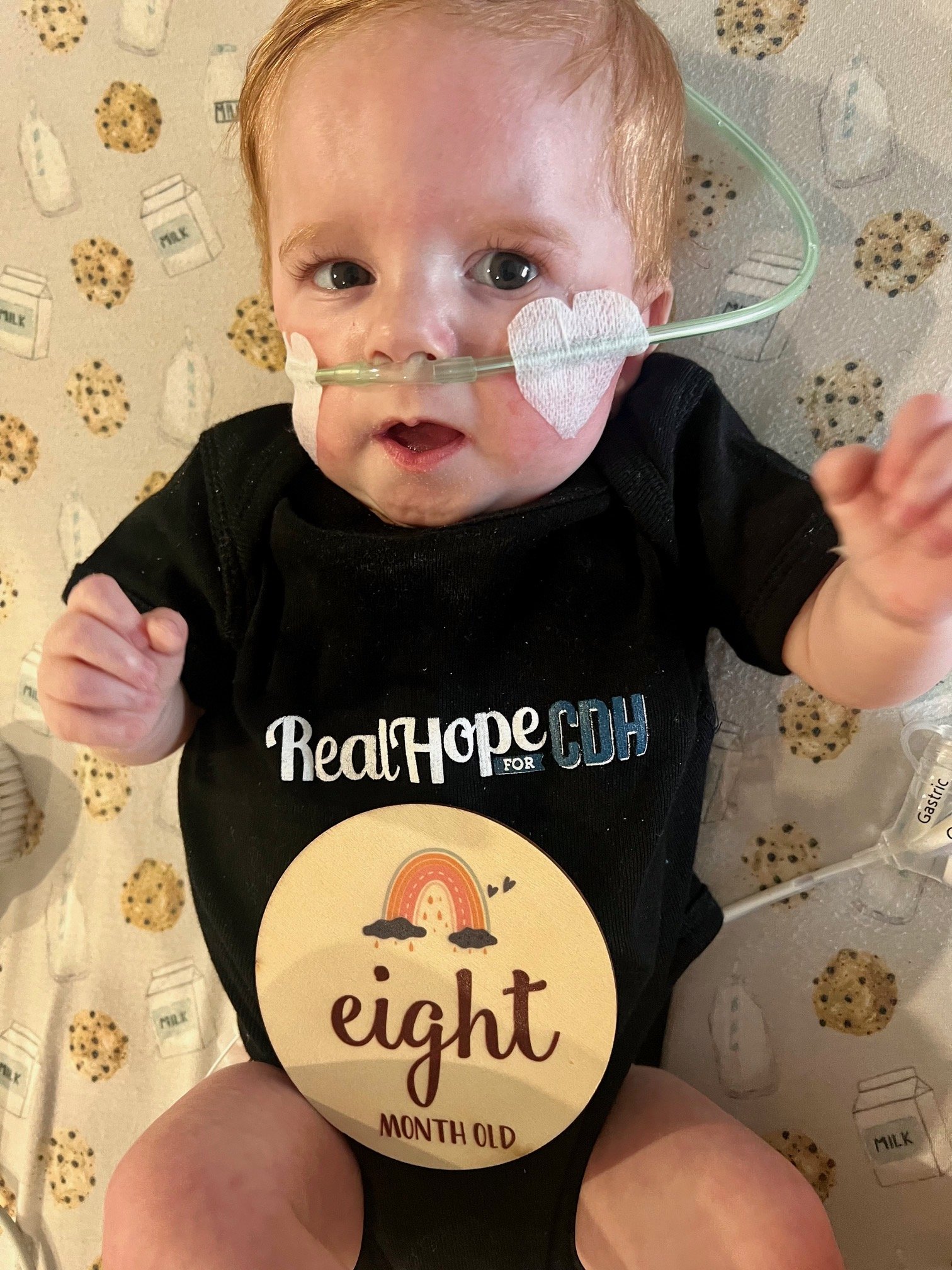 Tiny Hero Oliver 8 months - CDH and CHD