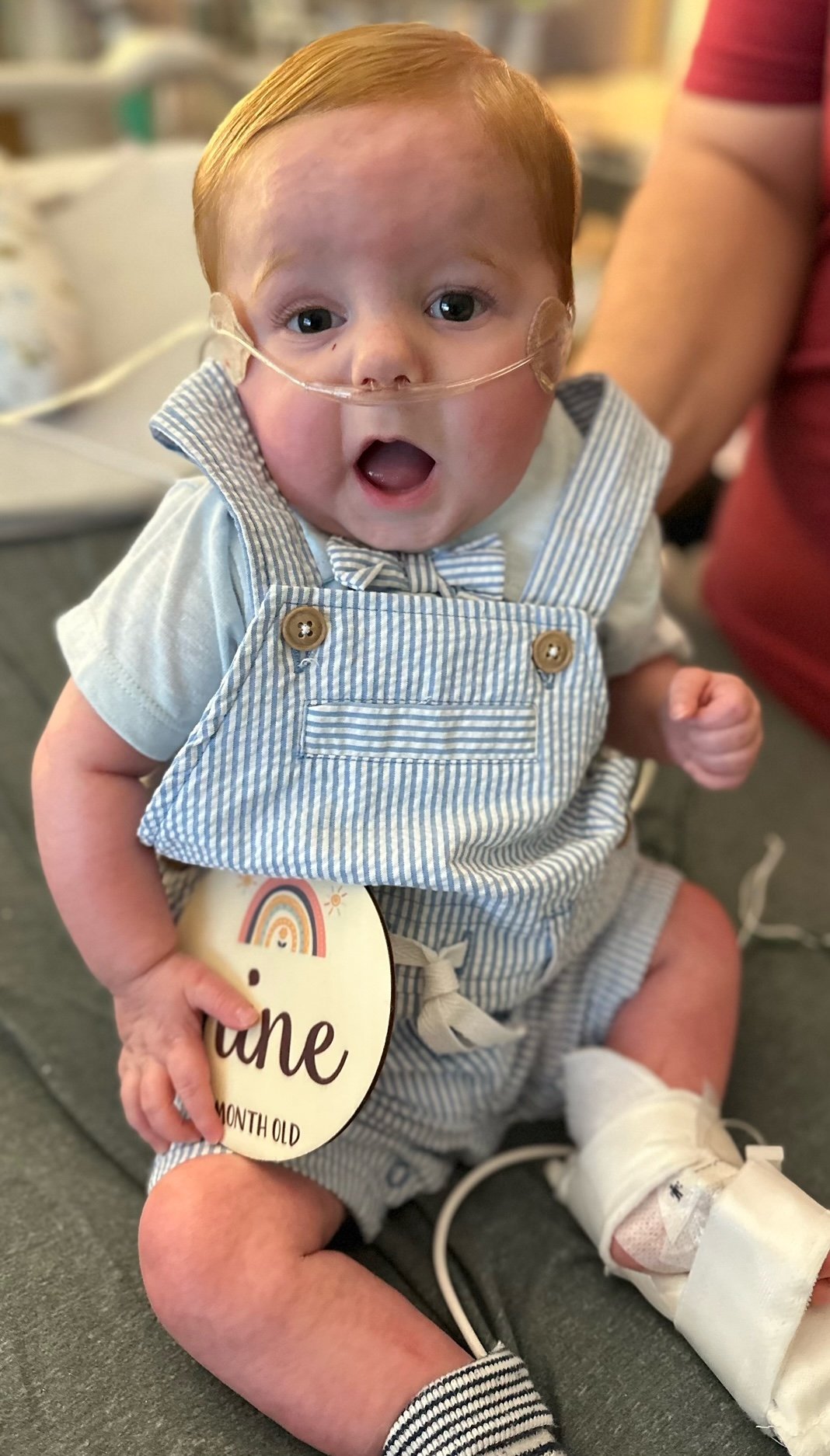 Tiny Hero Oliver 9 months - CDH and CHD