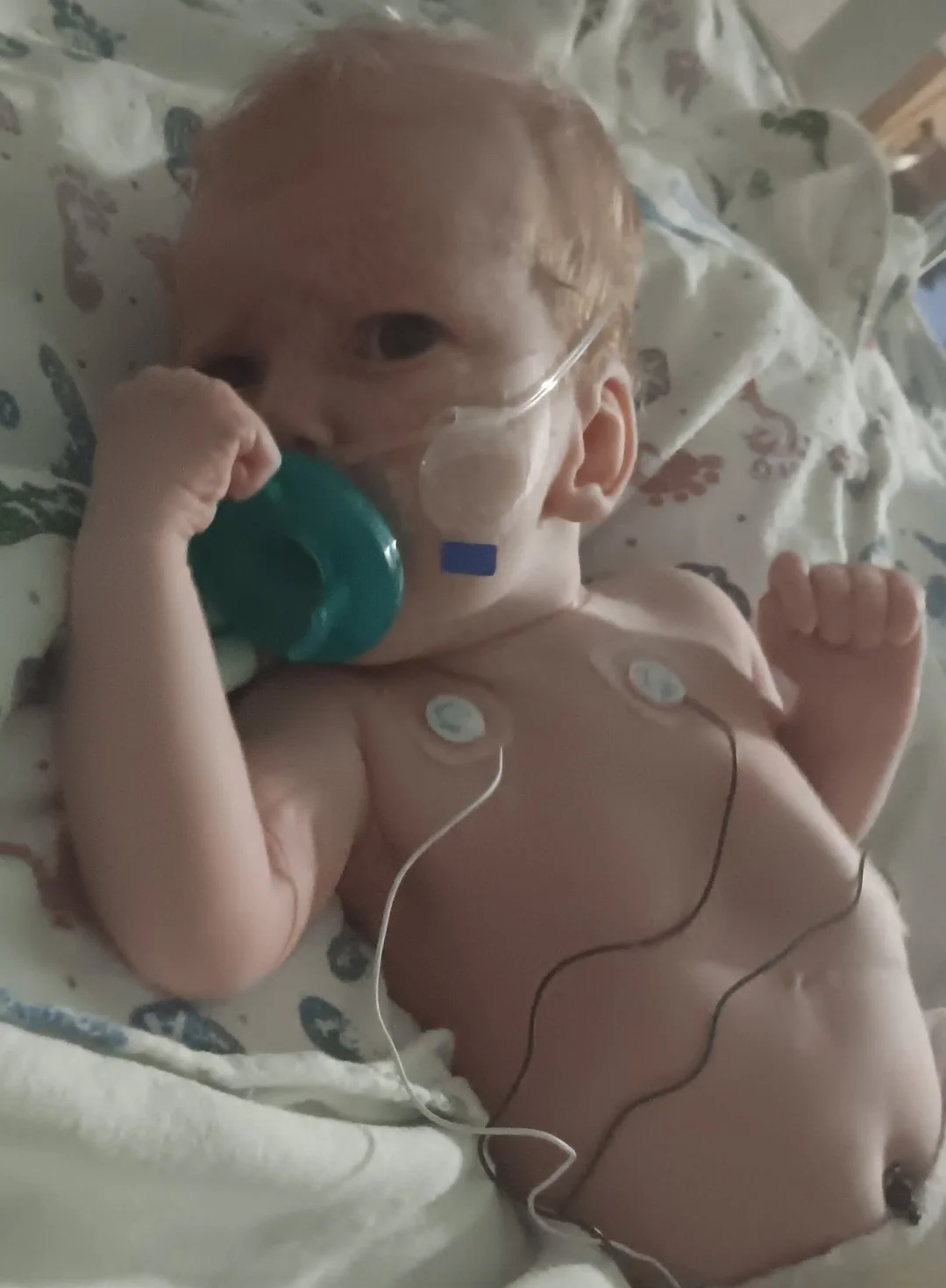 Violet S. LCDH ECMO 4.jpg