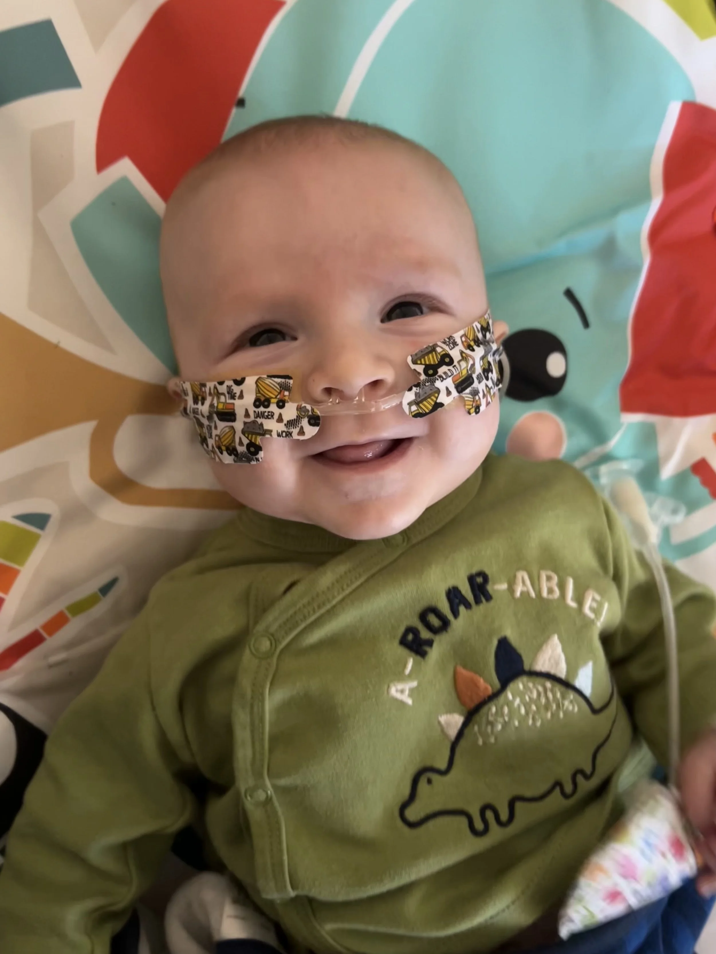 Thomas’ CDH Story