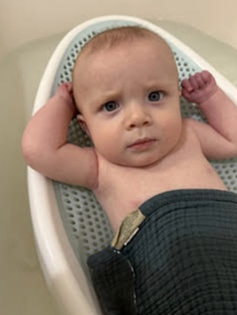 Ozzy’s CDH Story