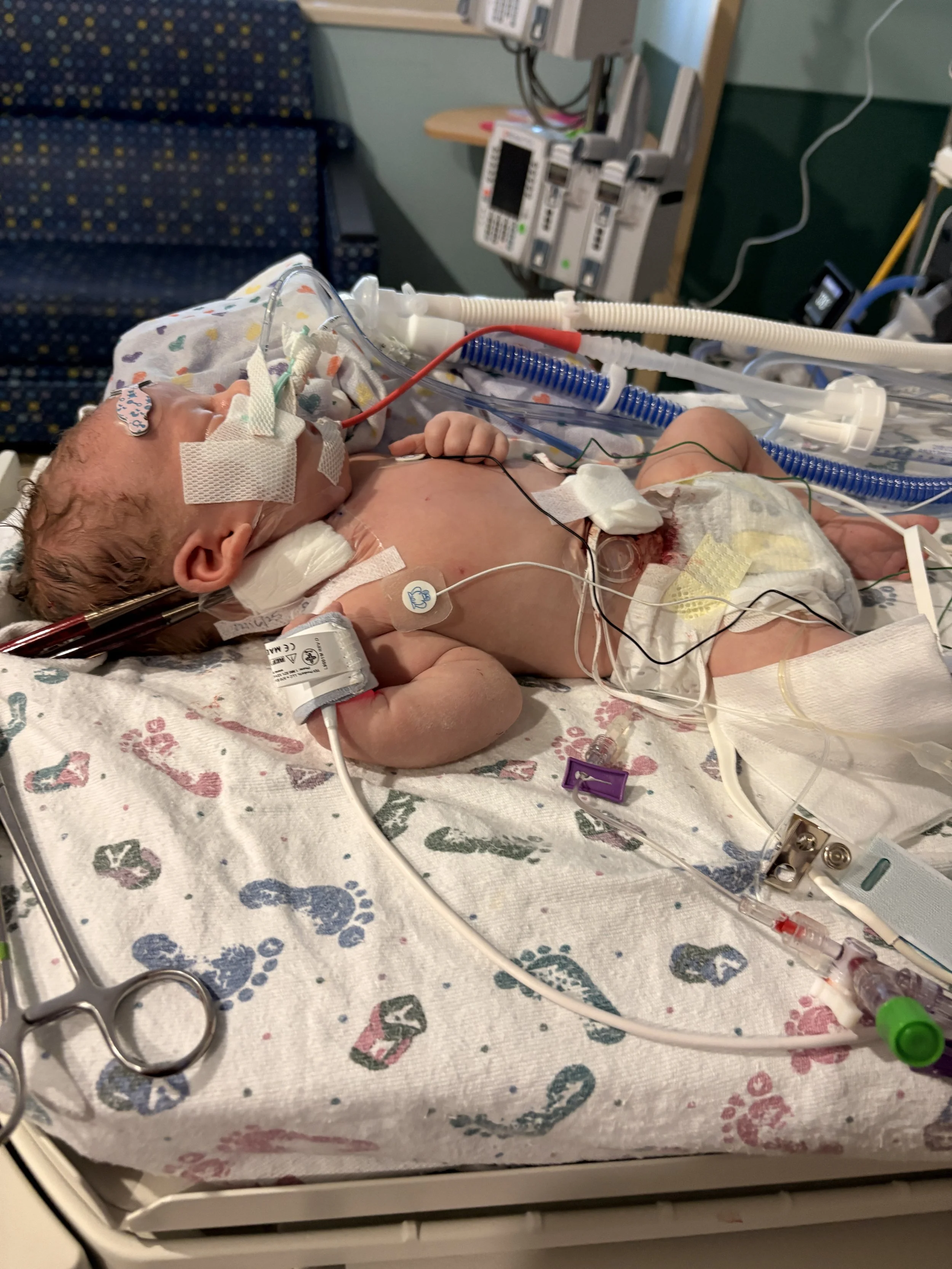 Maeve’s CDH Story