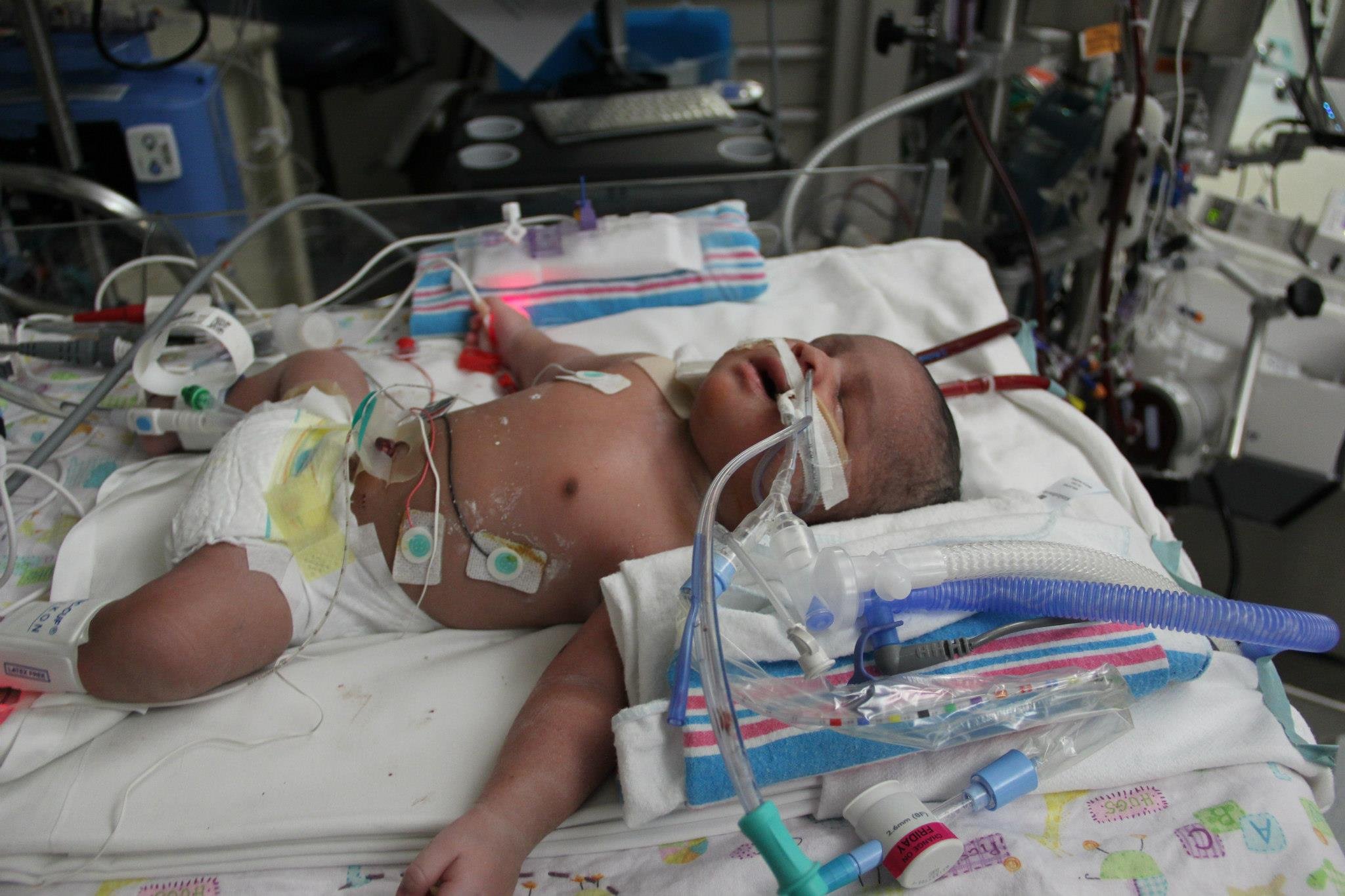 Tiny Hero Legacy on ECMO