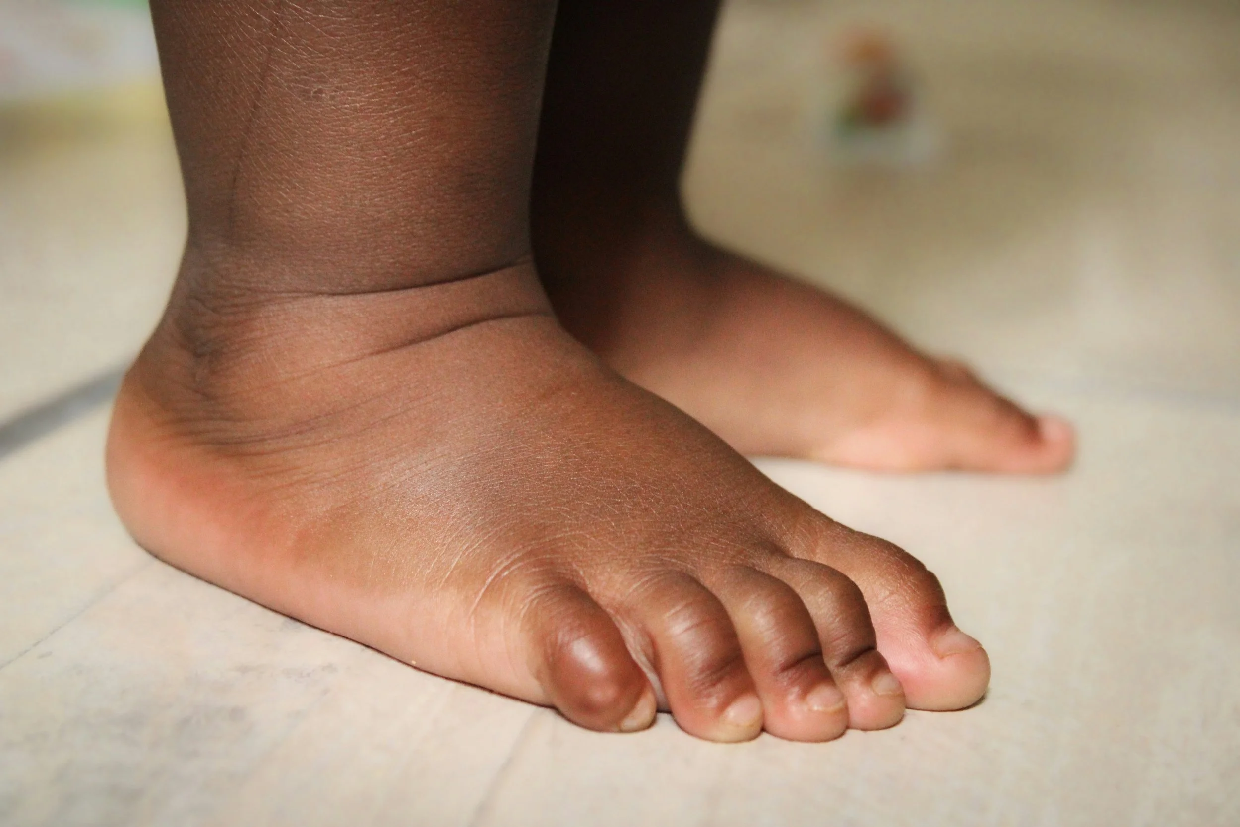 Close-up of a child's bare feet, standing on a light-colored tiled floor.