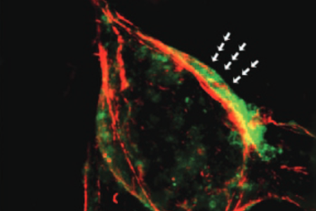Team Finds Molecular Trigger of Schizophrenia-like Behaviors and Brain Changes