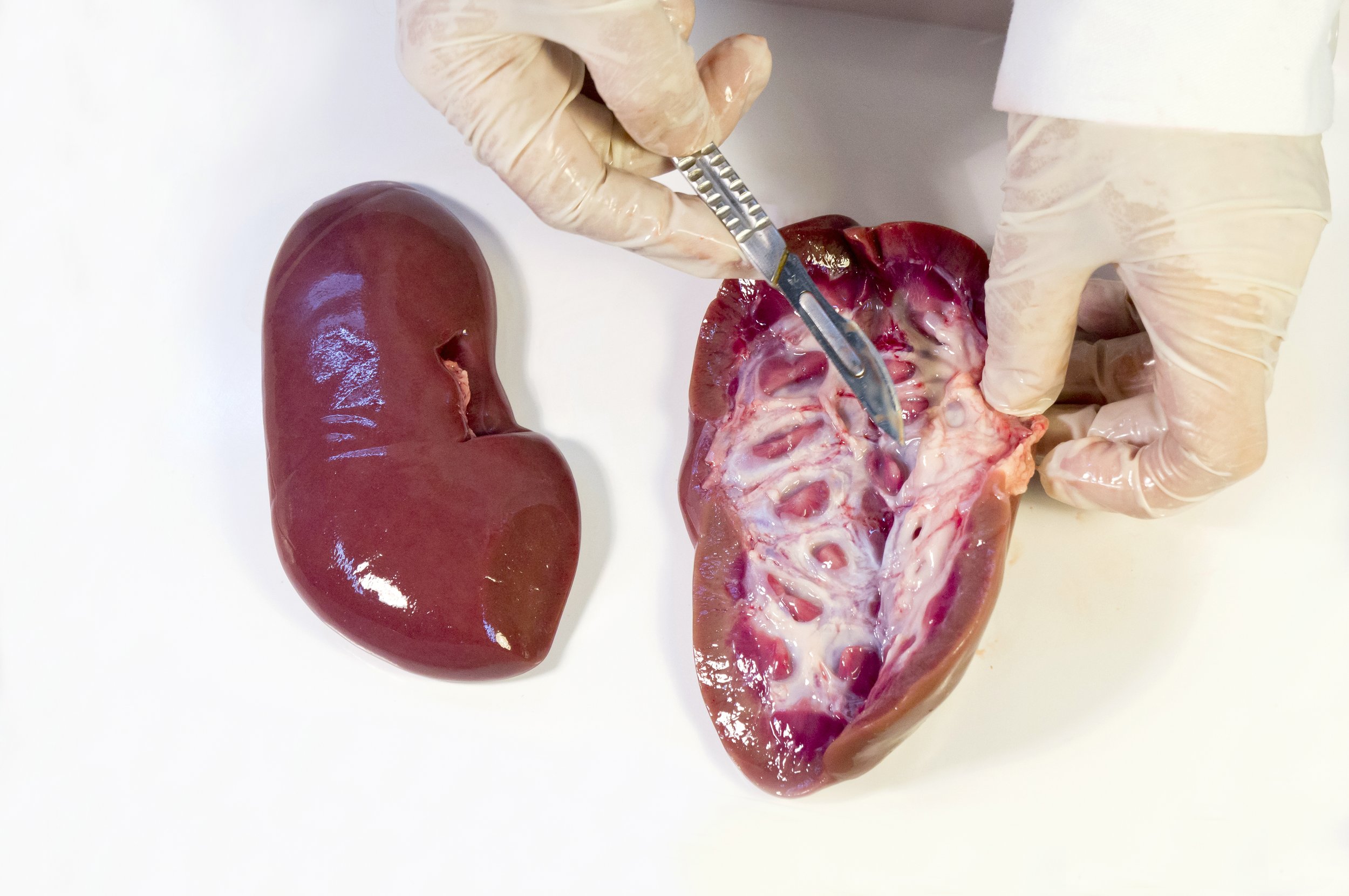 Dissected pig kidneys on a table, with one kidney opened to show internal structure and a gloved hand using a scalpel.
