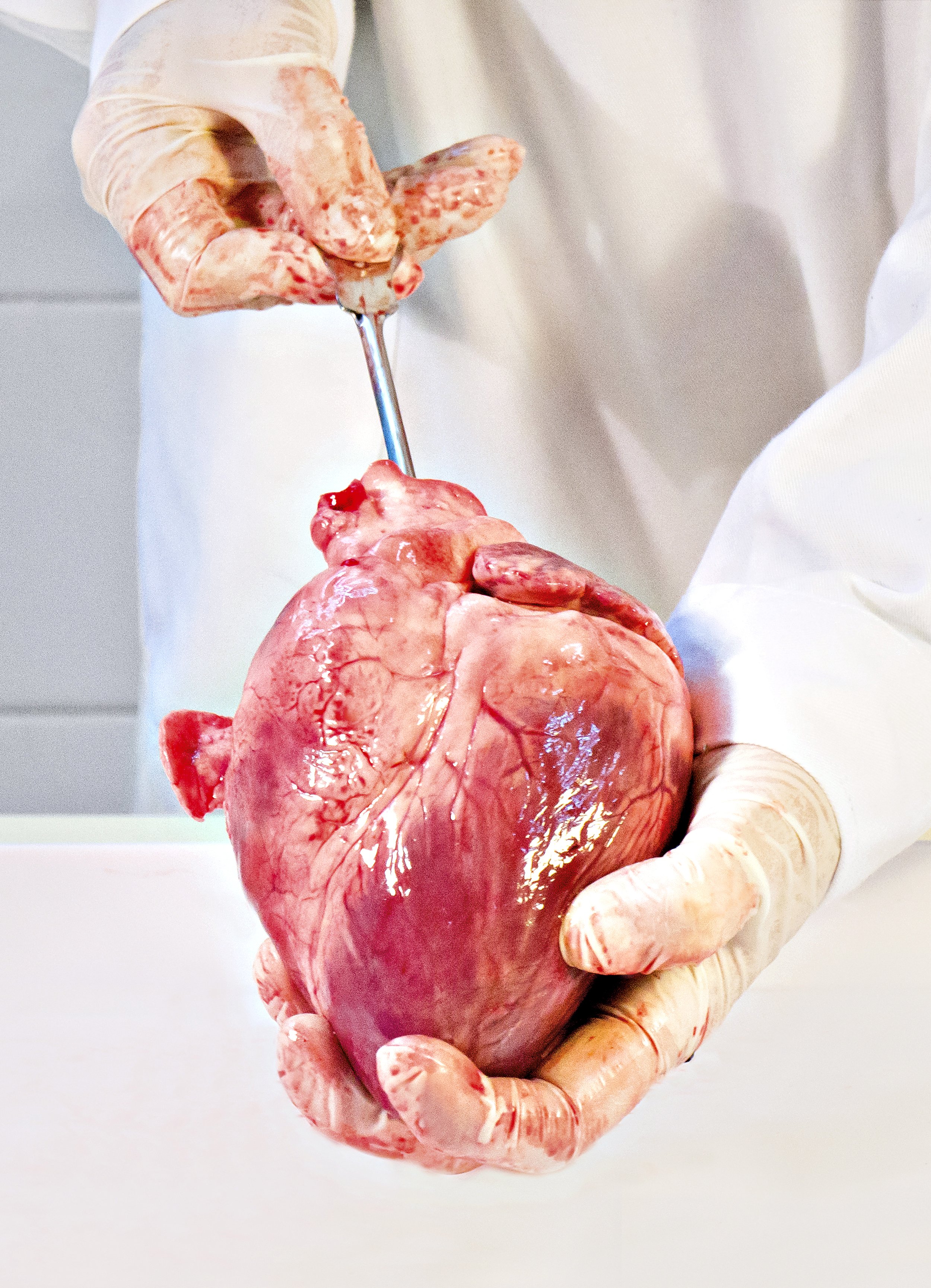 Person wearing gloves holding a raw animal heart with medical tools.