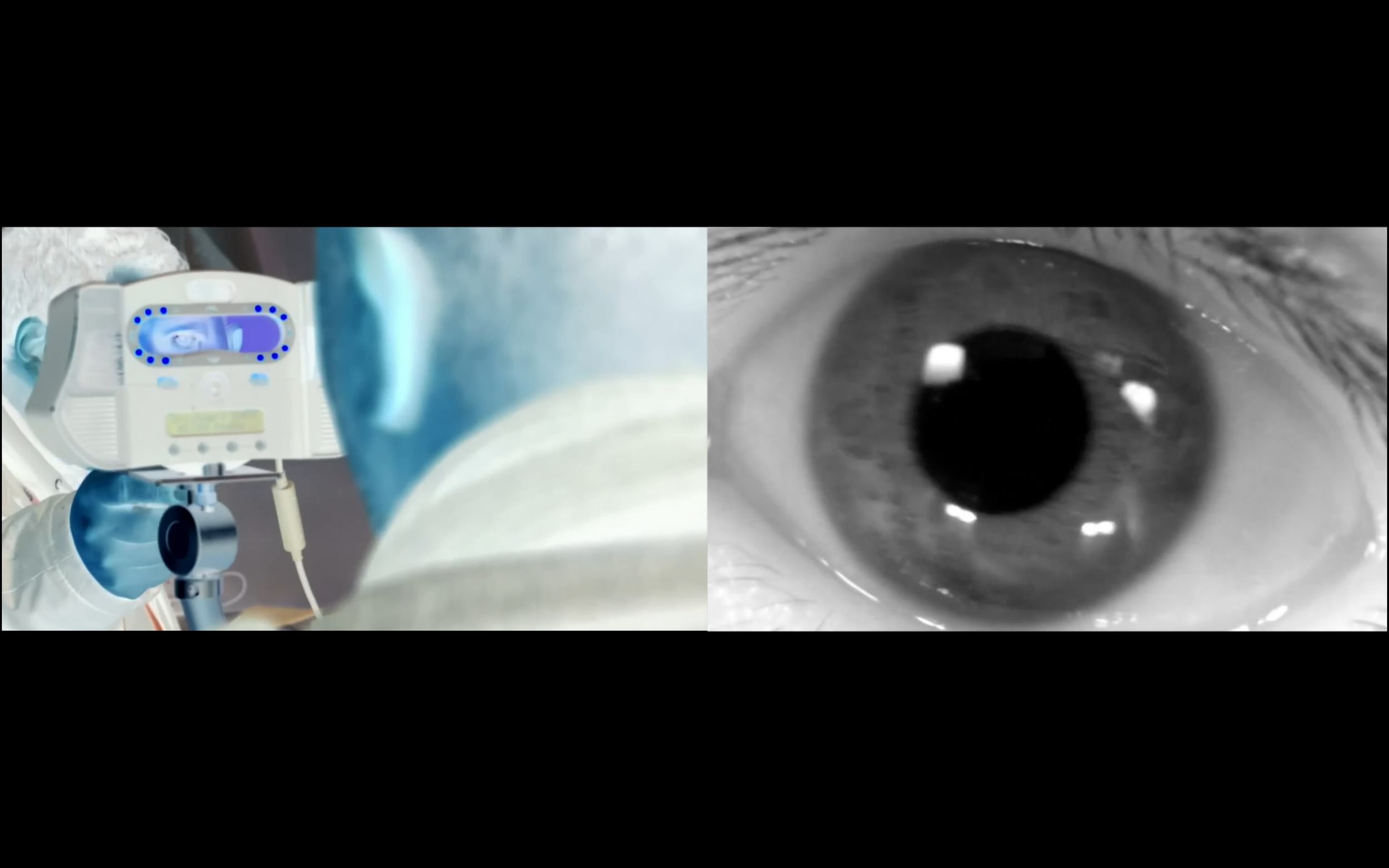 Porous bodies (detail of film in progress), 2026