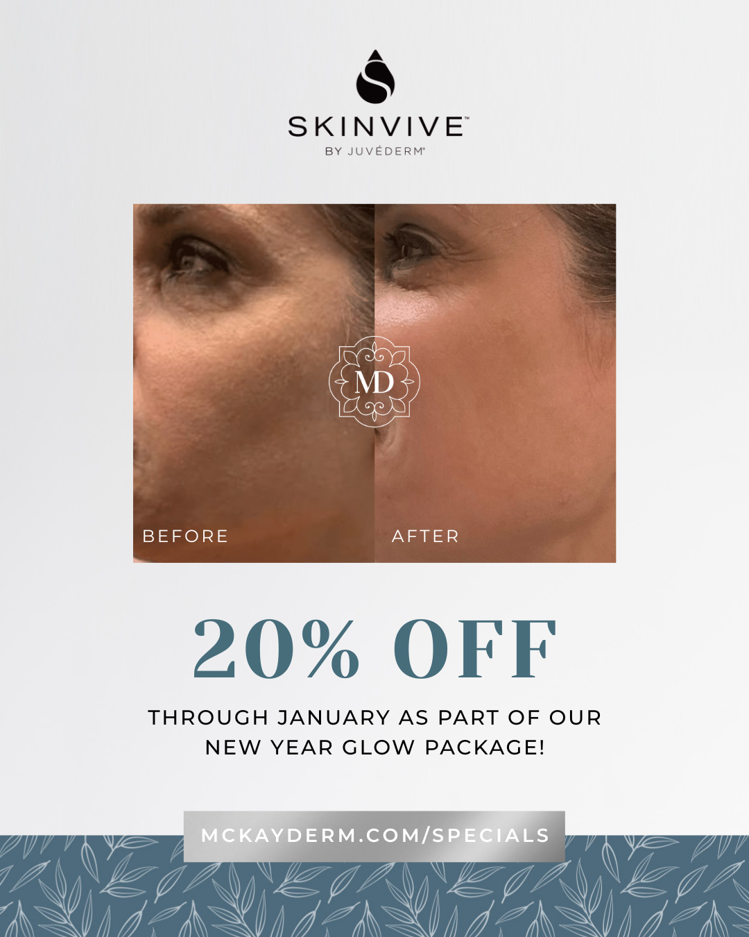 skinvive-stuart-florida-skin-hydration-injectable-medspa-treatment2026-01-02 at 11.57.52 AM 2.png