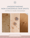 Understanding Non-Cancerous Skin Spots — and When to Consult a ...