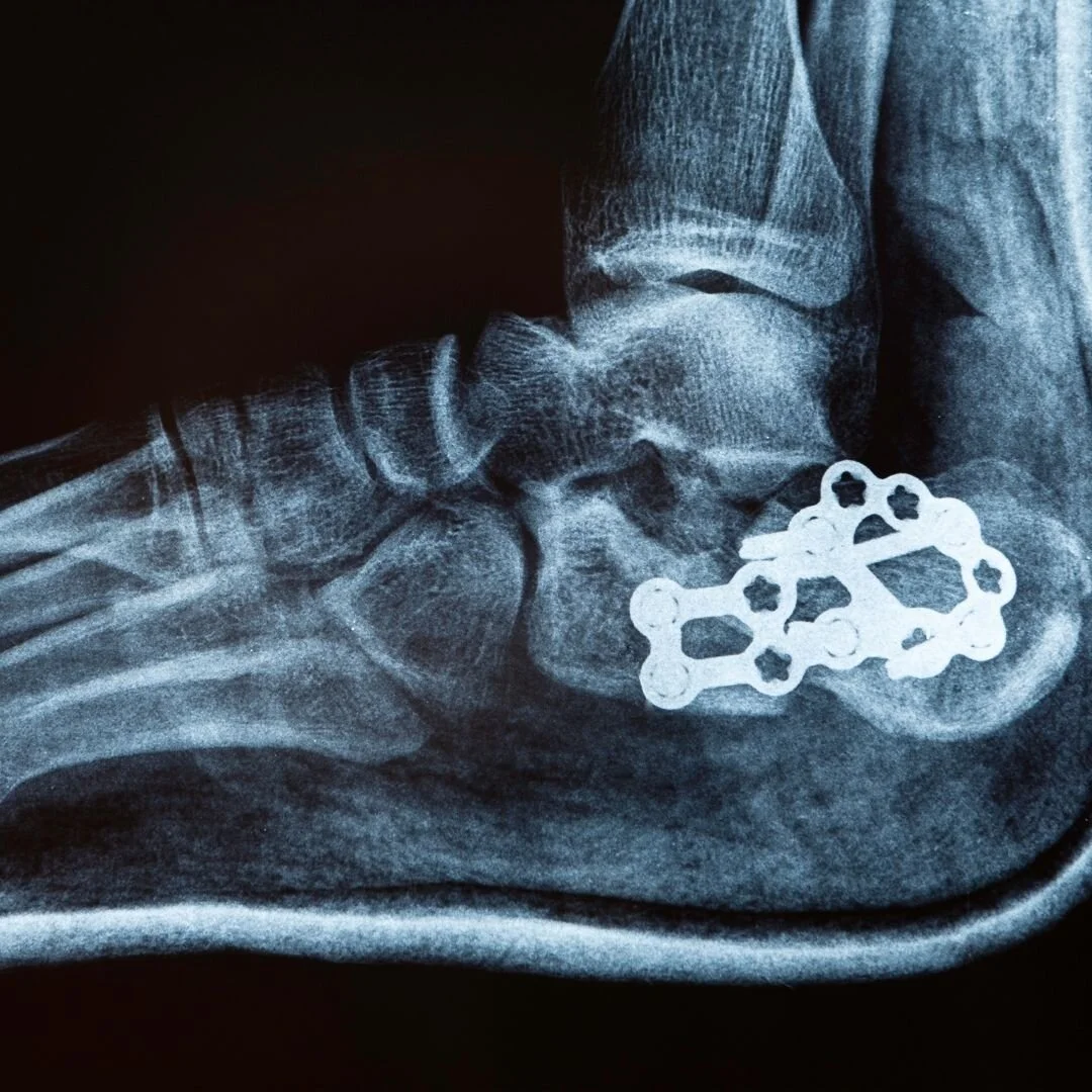 Some of the smallest injuries can cause long lasting pain.
