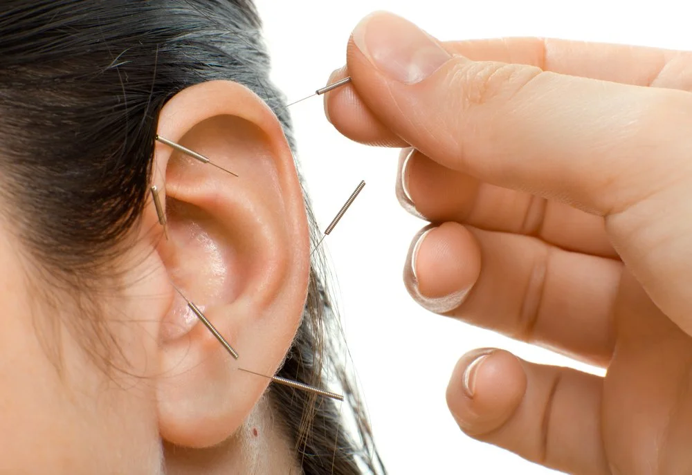 Auricular Acupuncture.jpg