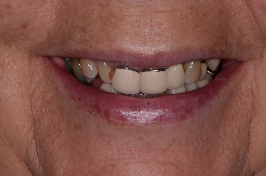 Blog Post Title Three