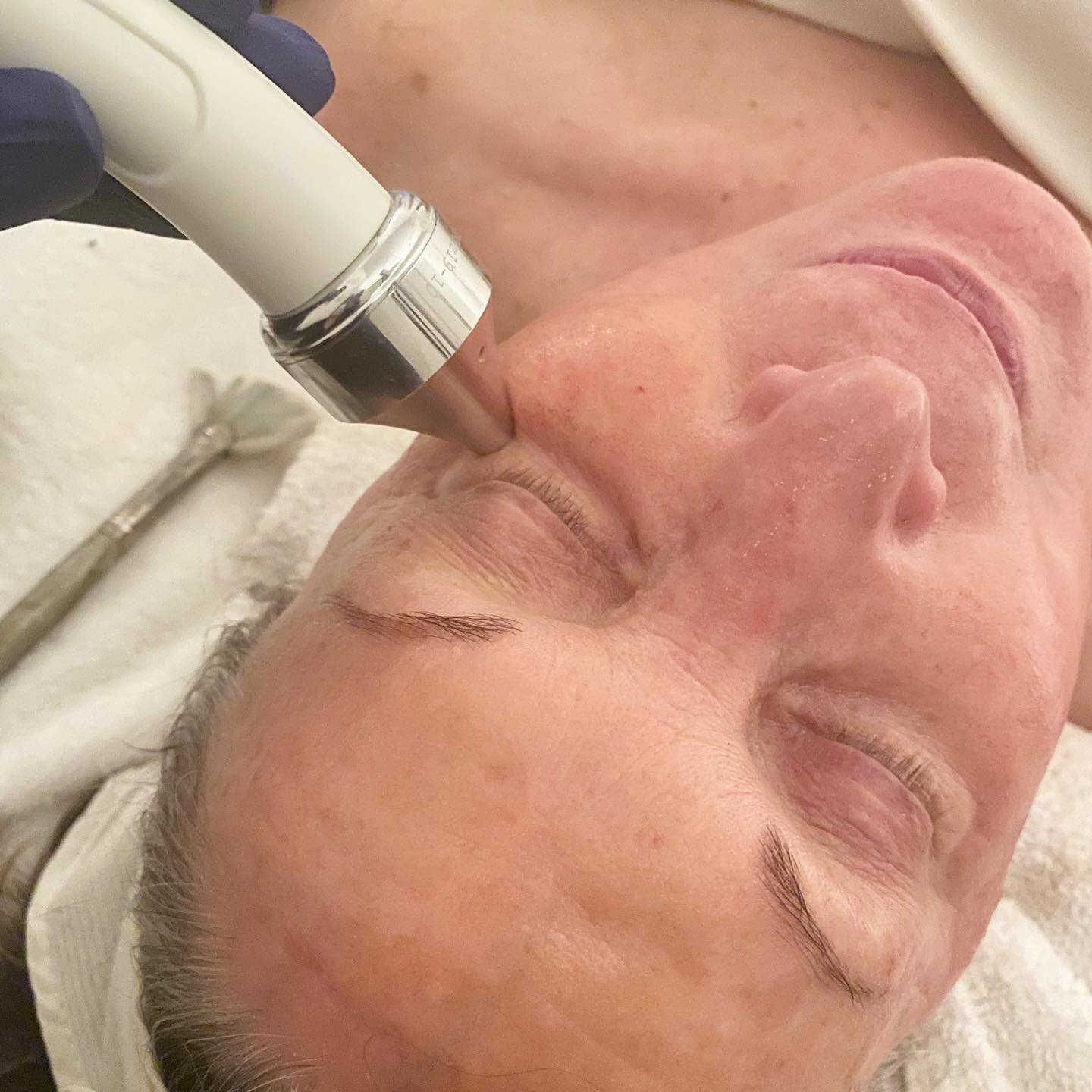 Ultrasound/Ultrasonic treatment- The result? Clear, healthy skin with noticeably tighter pores. *gently stimulates skin to encourage collagen and elastin production. With a series of treatments, fine lines and wrinkles are less noticeable*stimulates 