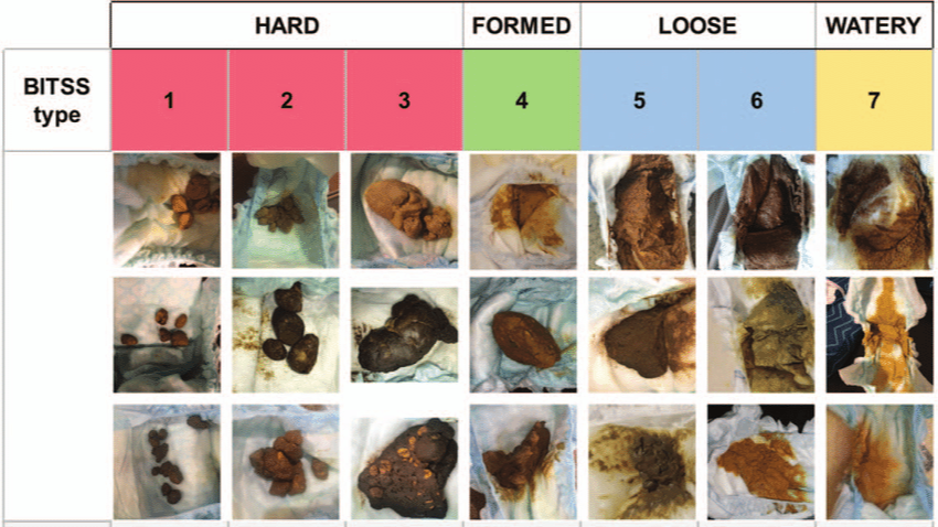 Bristol stool chart with real pictures of stool