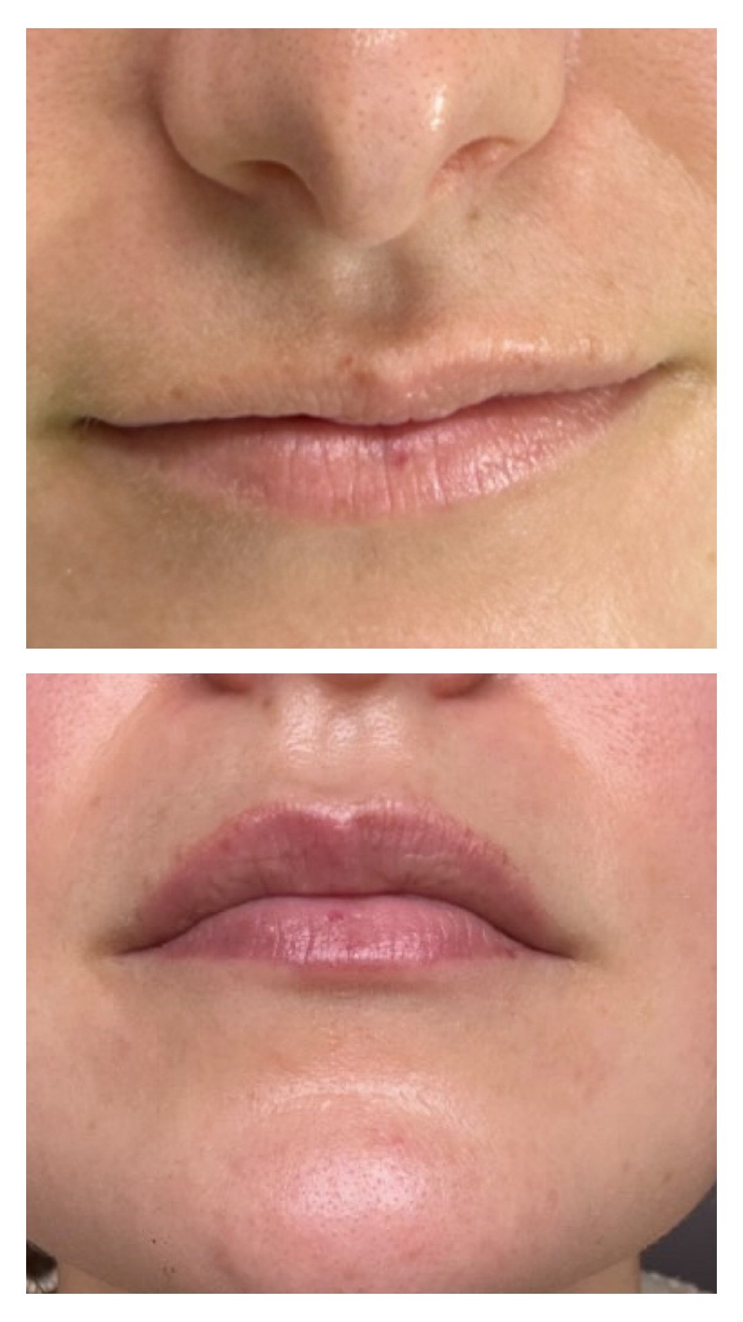 Before/After