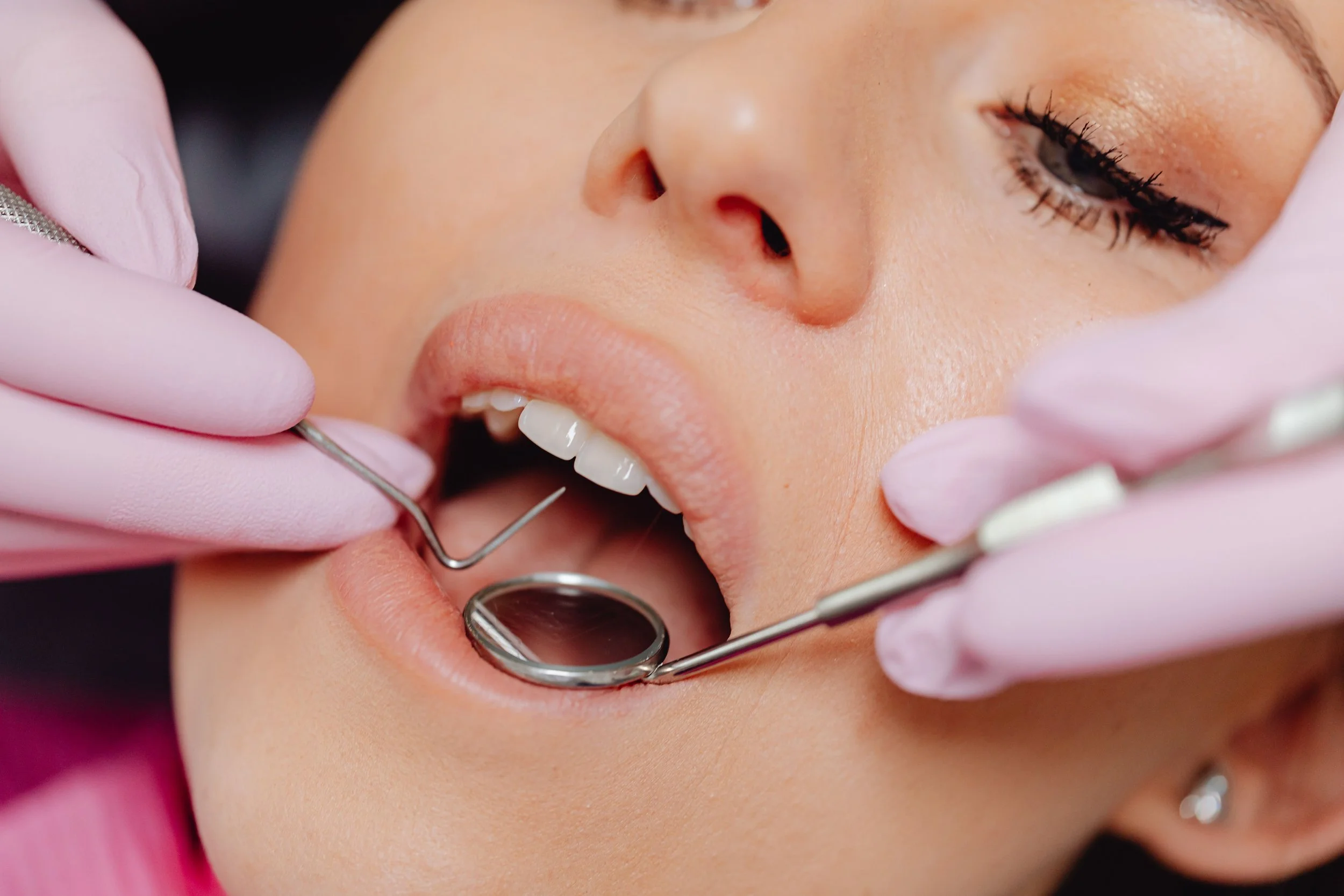 What Happens at a Dental Check-Up? A Guide for NZ Patients