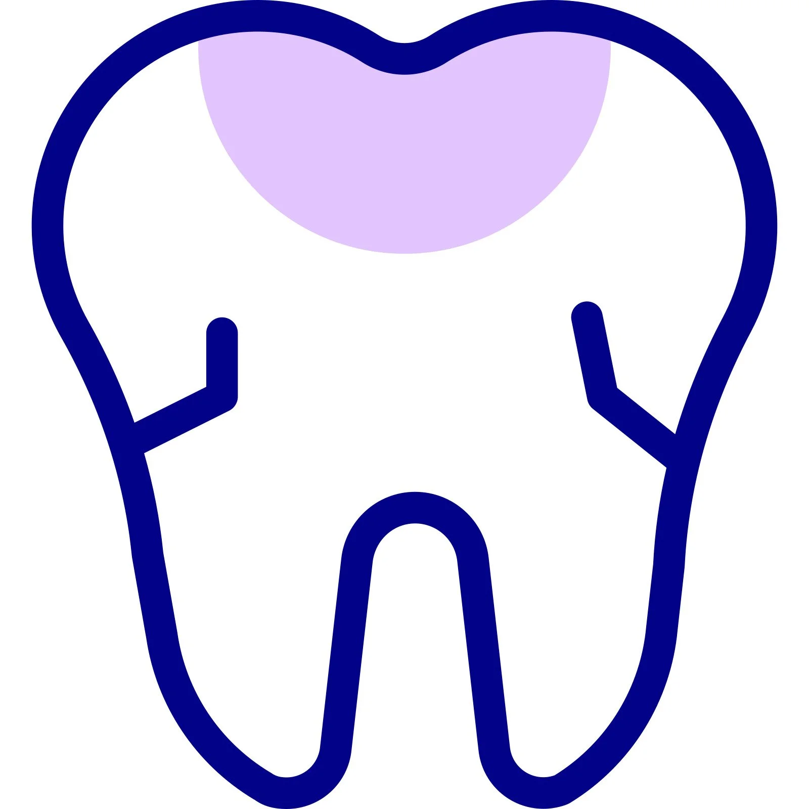 Tooth-coloured composite fillings for cavity repair
