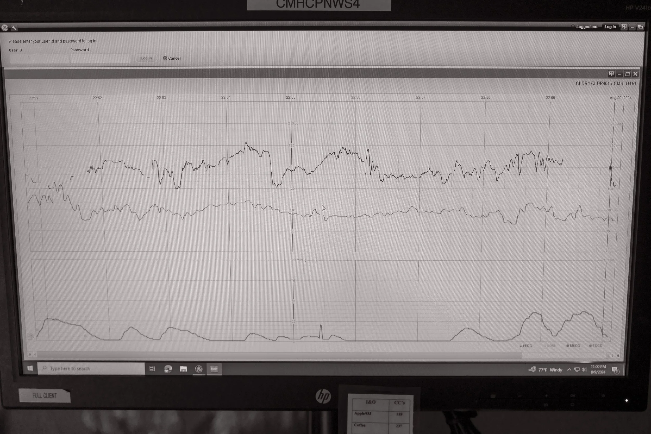 Aly's heart rate, contraction timing, and Jack's heart rate; 8/9