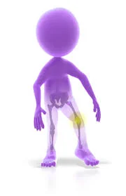 With Bad Movement, Come Bad Knees