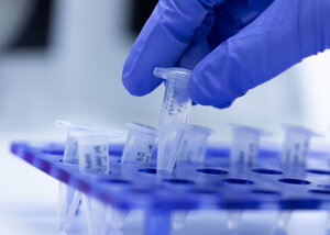   B.O.D. tests      Enzyme testing      Serum studies