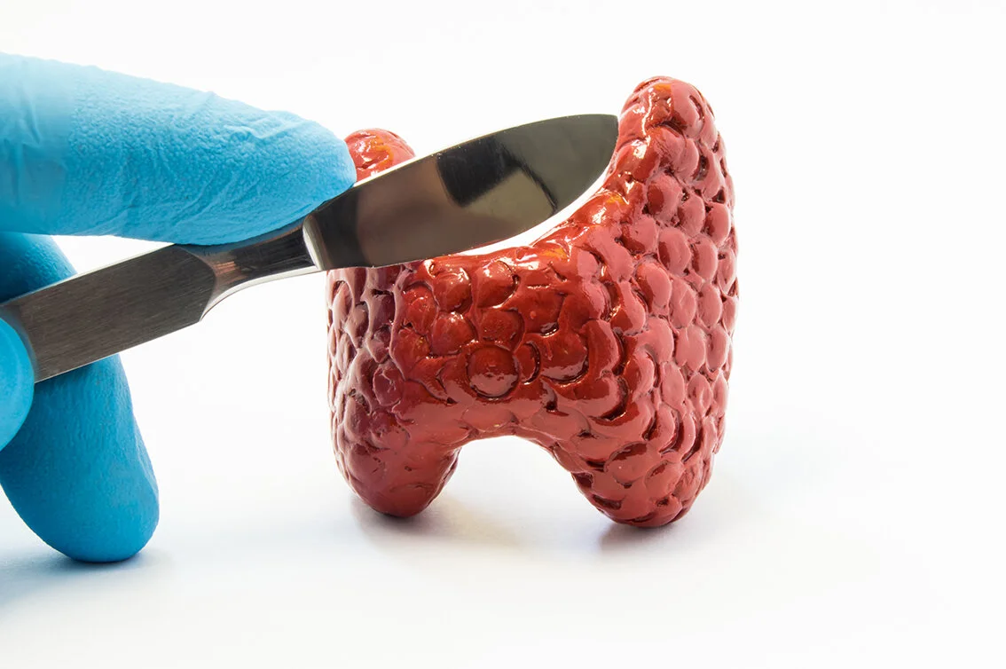 Thyroid Surgery Dr Jeremy Khoo Melbourne