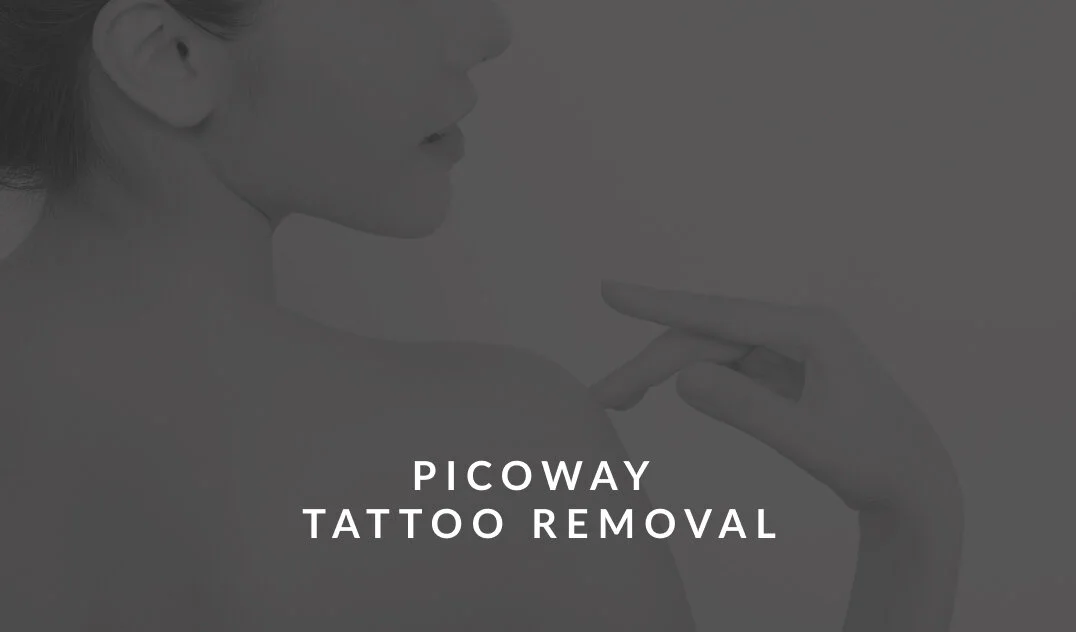 Picoway Tattoo Removal — illume