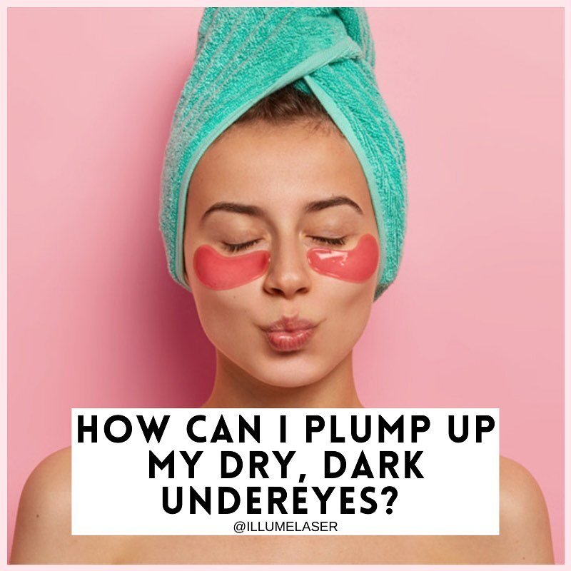 DULL UNDEREYES? 👀  SWIPE for tips on how to hydrate and plump your peepers!