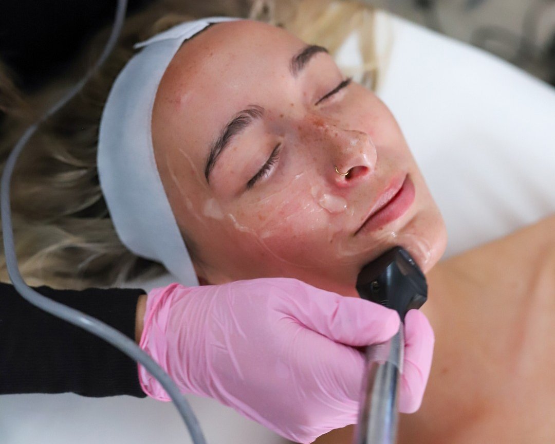 Comox Valley’s Facial or Hollywood’s Facial?