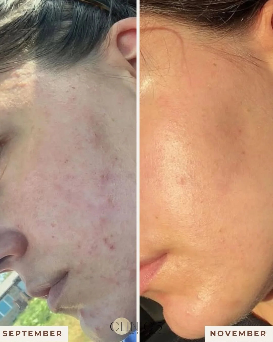 Clinic 5 Transformation (red light 3).jpg